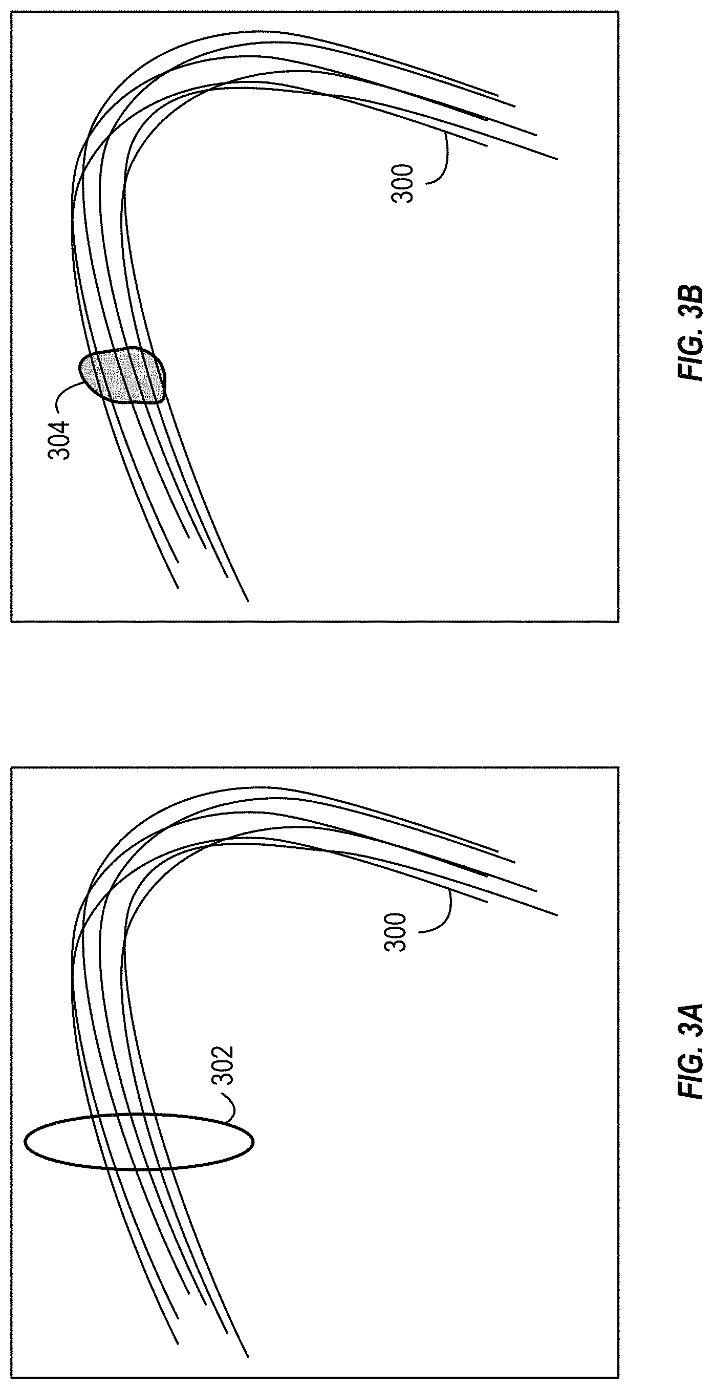 Patent US11782113 Figure 3 – Fiber tracking and segmentation
