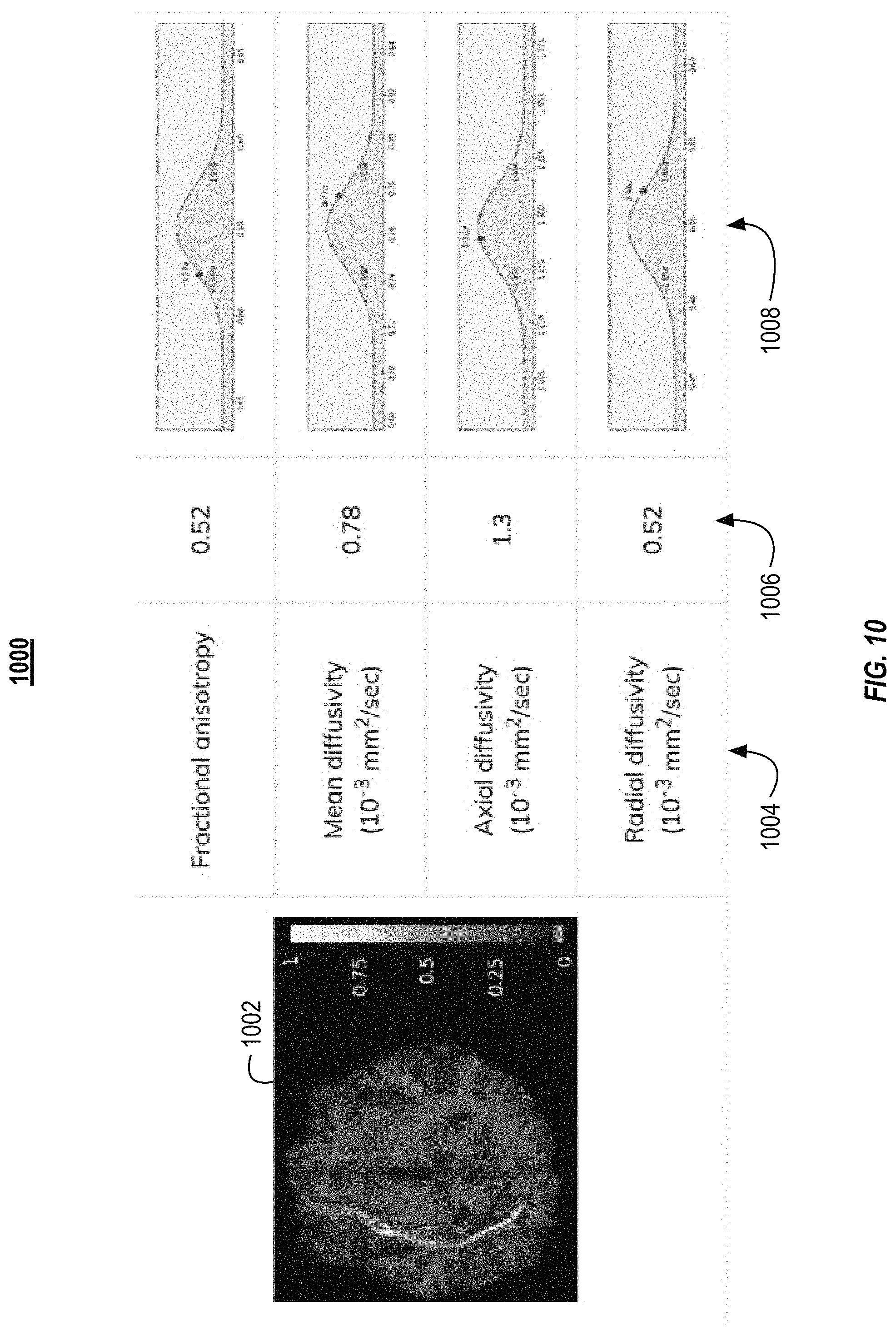 Patent US11782113 Figure 10 – Fiber tracking and segmentation