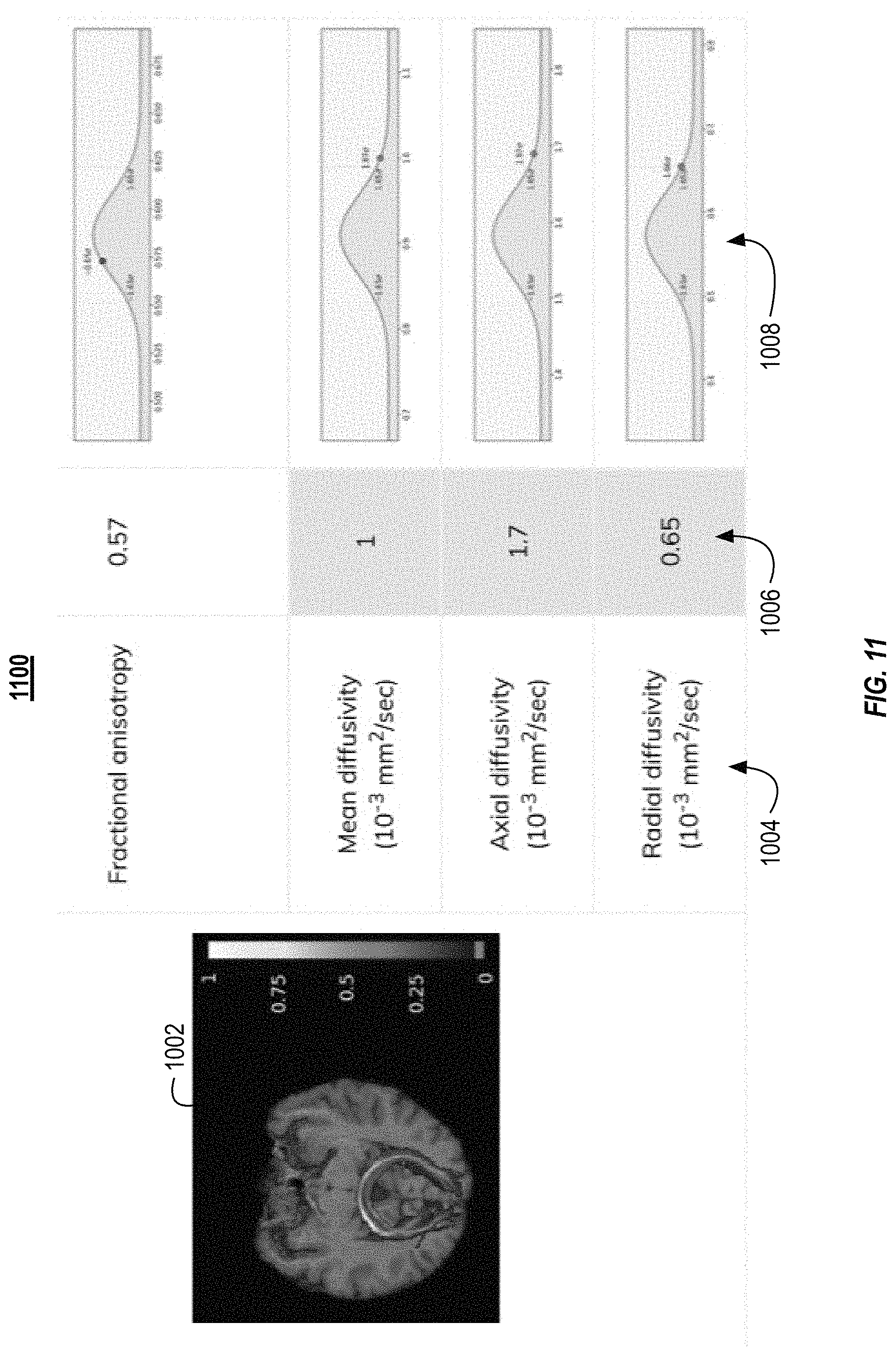 Patent US11782113 Figure 11 – Fiber tracking and segmentation