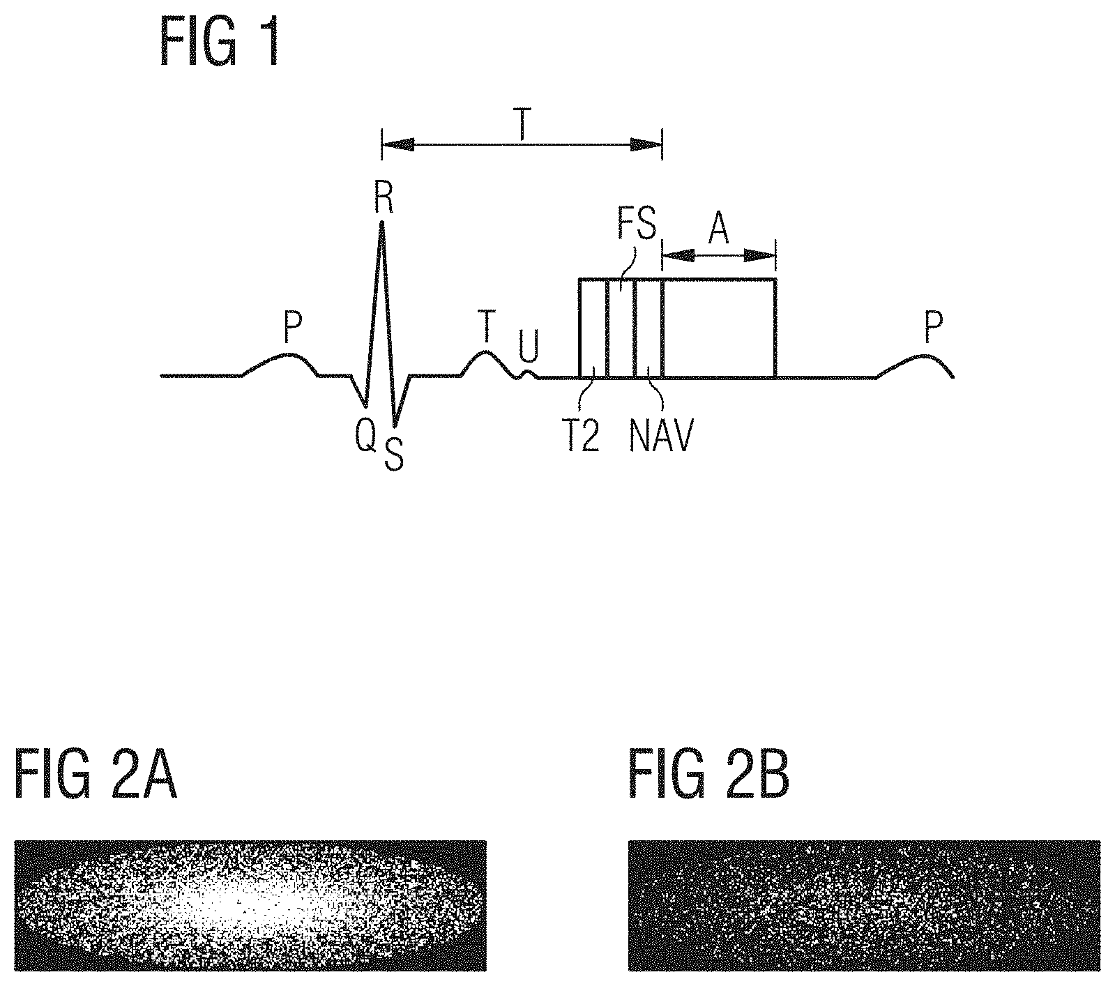 Patent US11782115 Figure 1 – Image reconstruction method