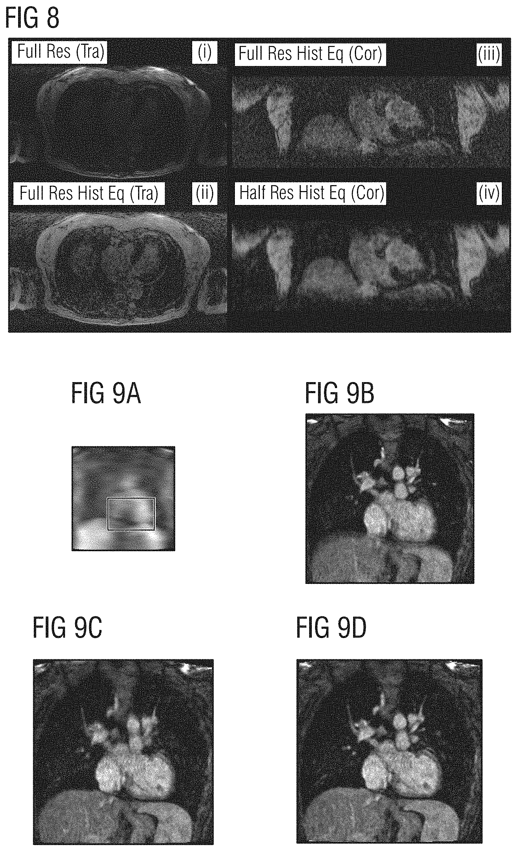 Patent US11782115 Figure 5 – Image reconstruction method