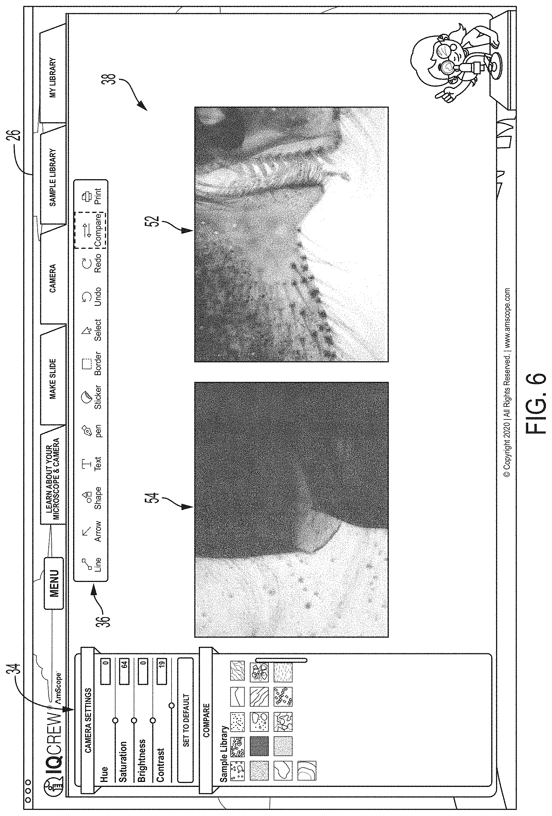 Patent US11782254 Figure 5 – Digital microscopy system and graphical user interface