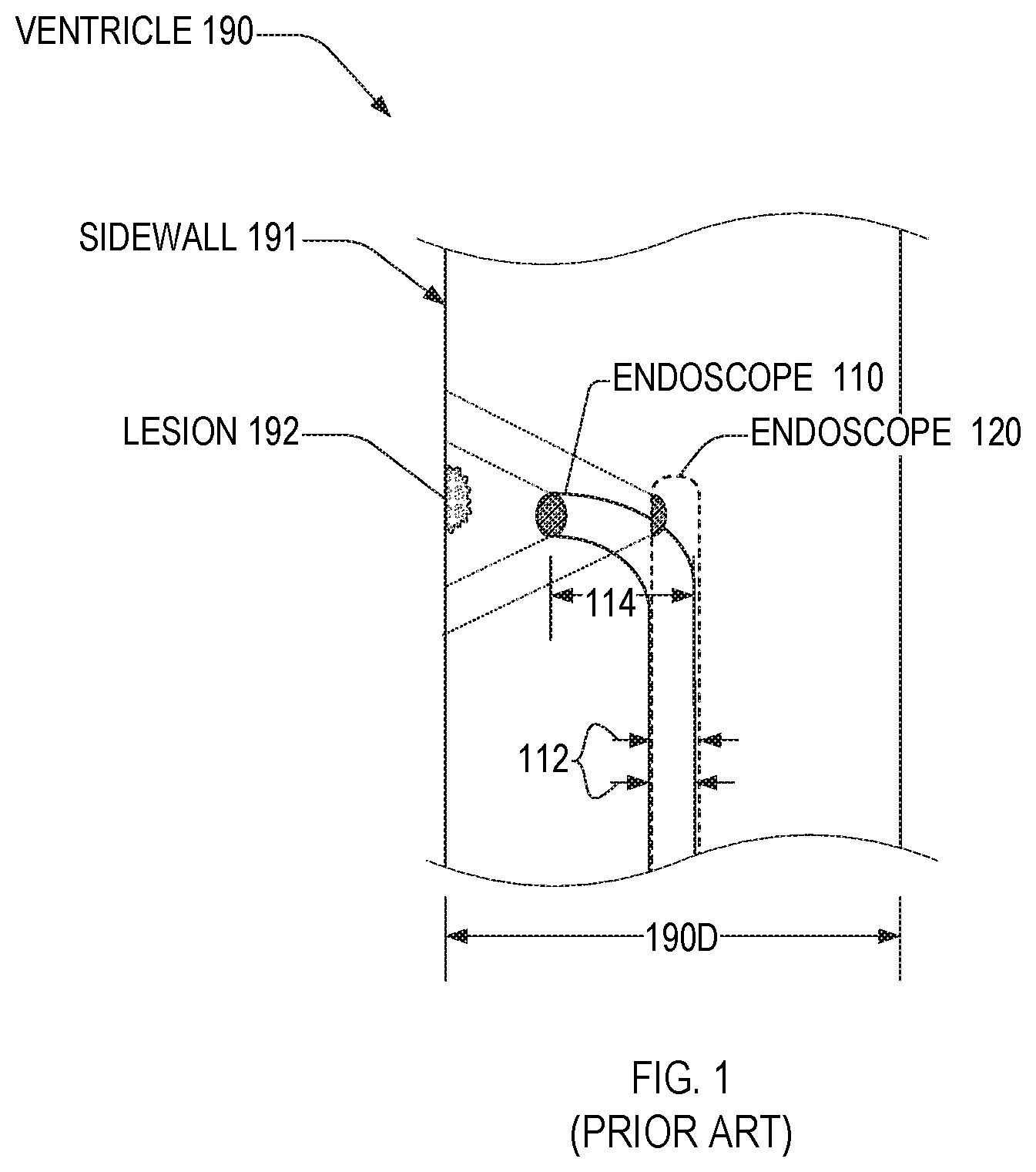 Patent US11782256 — Endoscope imager and associated method — Figure 1