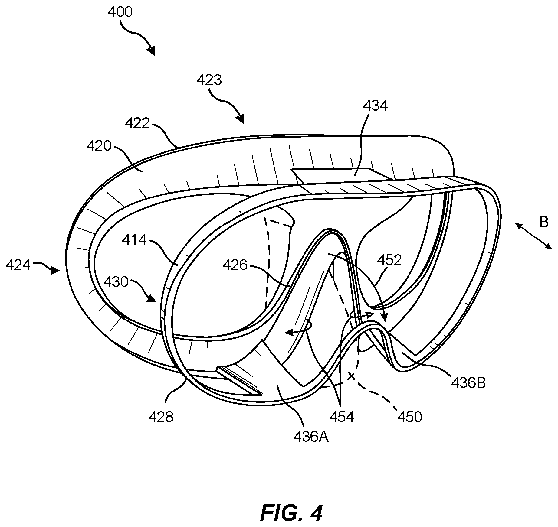 Patent US11782282 Figure 4 – Facial interface assemblies for head-mounted displays and related systems and methods