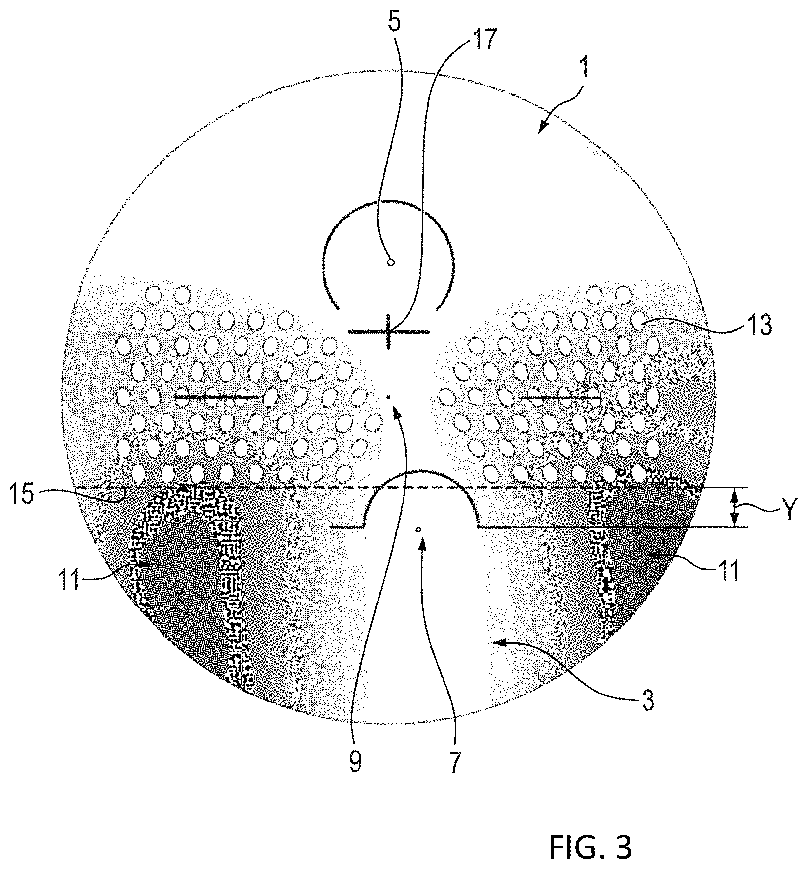 Patent US11782293 Figure 3 – Progressive addition lens for myopia control and method of manufacturing the same