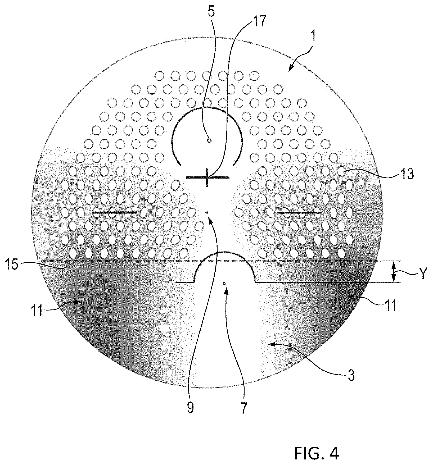 Patent US11782293 Figure 4 – Progressive addition lens for myopia control and method of manufacturing the same