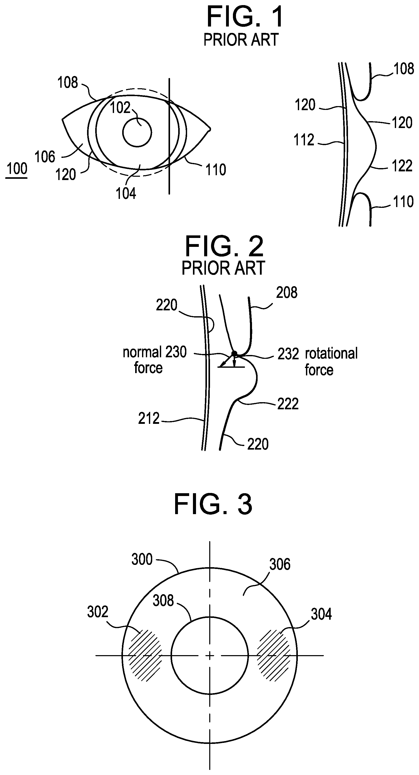 Patent US11782295 Figure 1 – Friction stabilized contact lenses