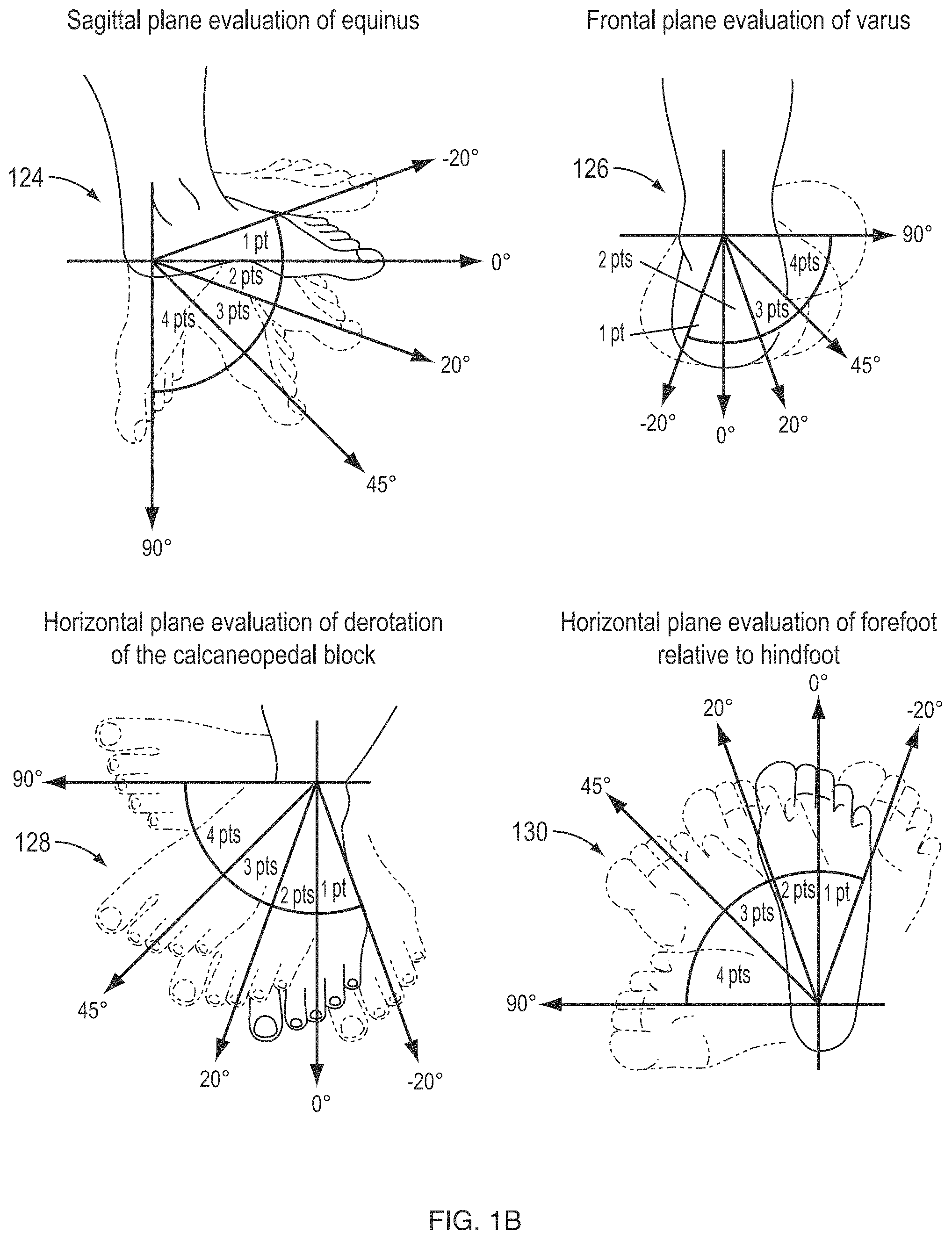 Patent US11783102 Figure 2 – Predictive modeling platform for serial casting to correct orthopedic deformities