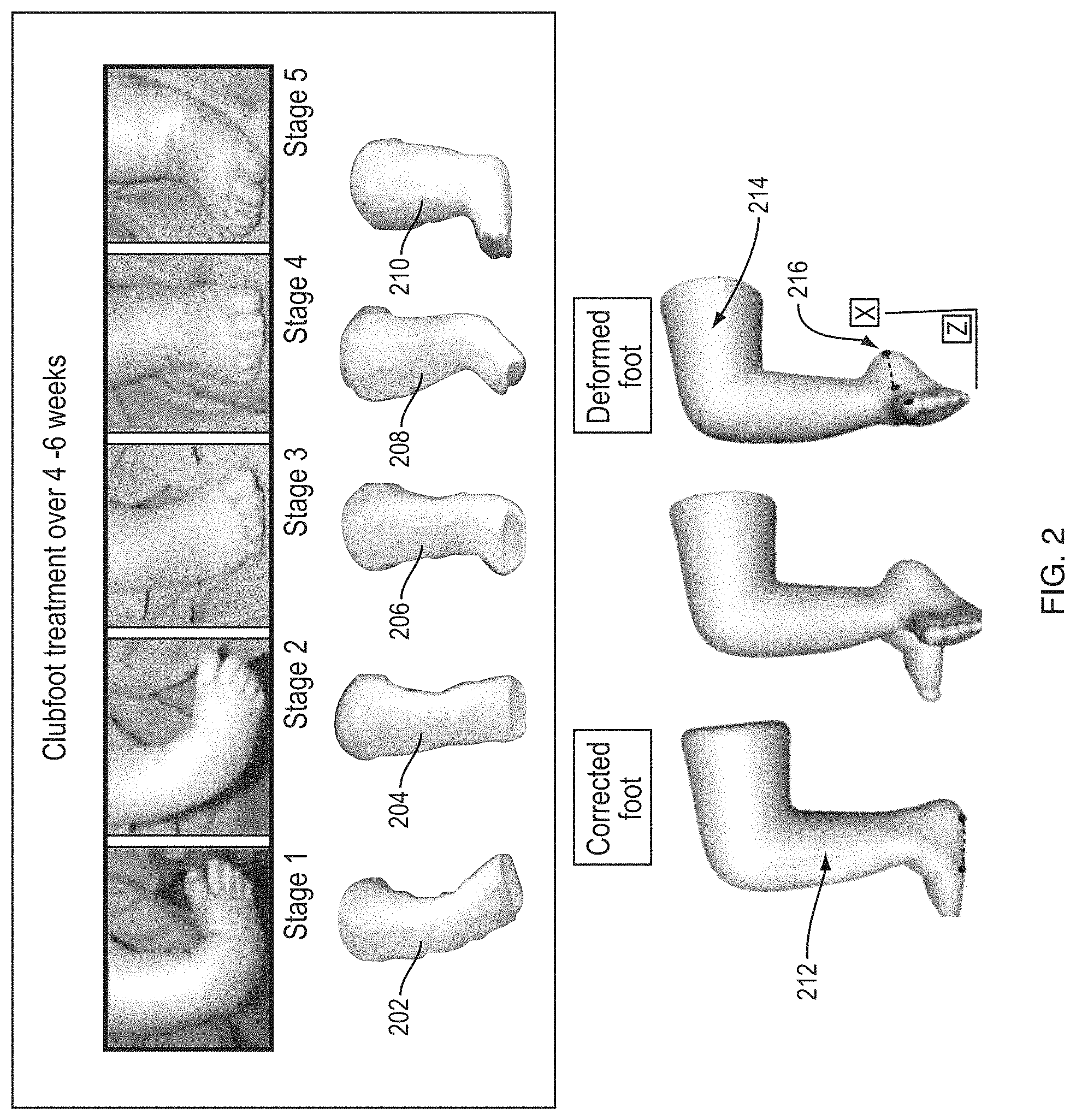 Patent US11783102 Figure 3 – Predictive modeling platform for serial casting to correct orthopedic deformities