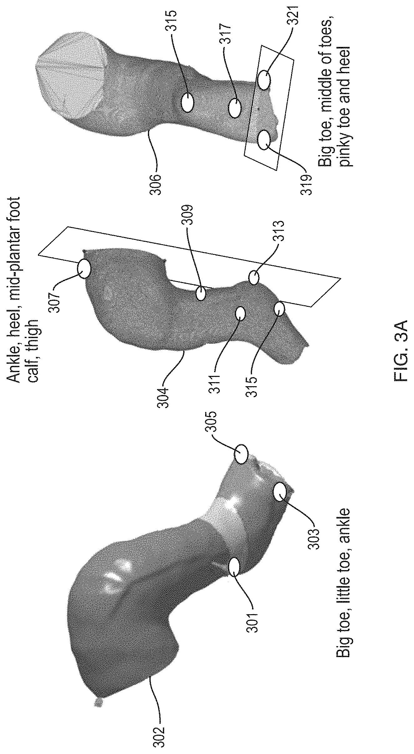 Patent US11783102 Figure 4 – Predictive modeling platform for serial casting to correct orthopedic deformities