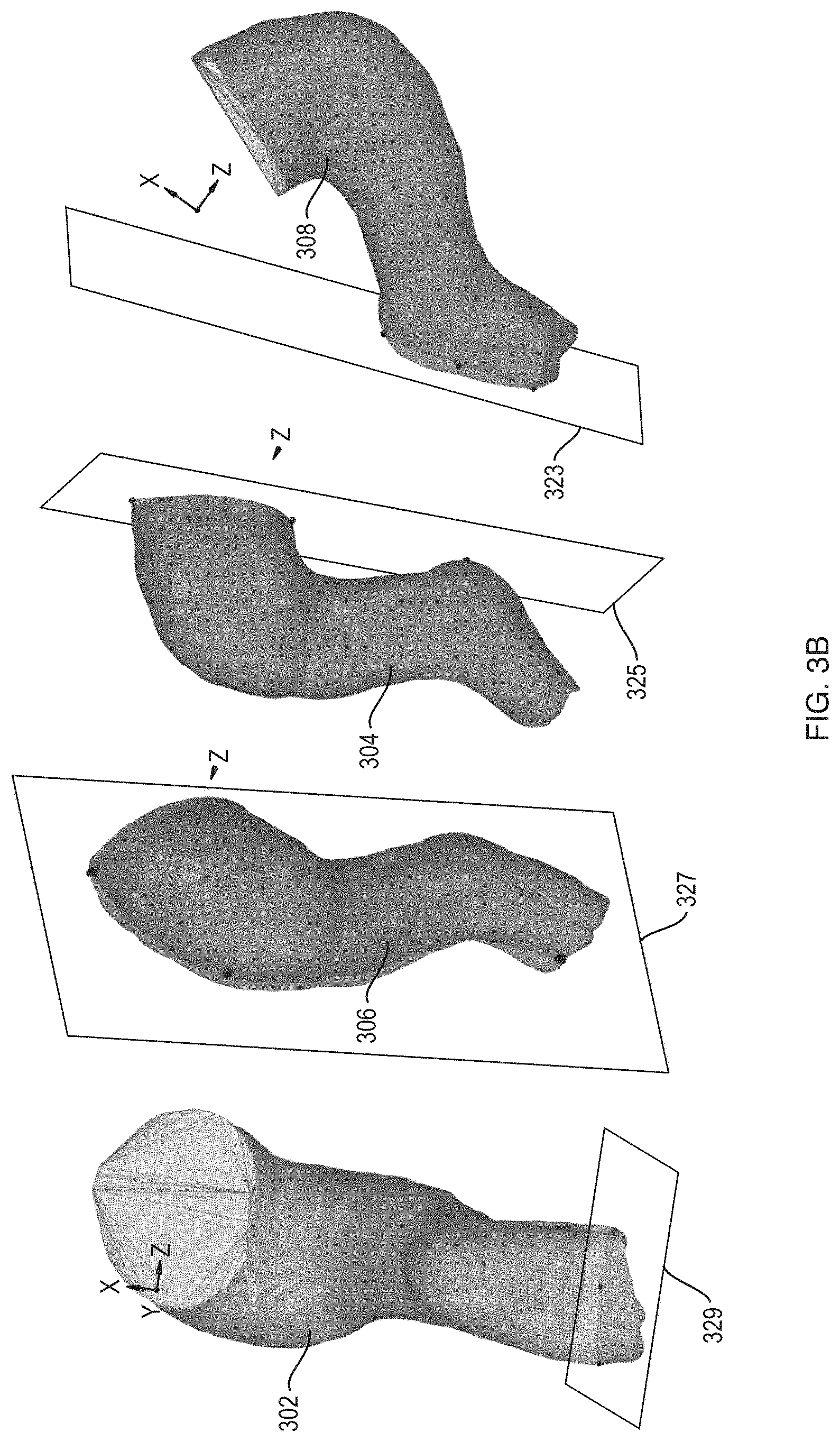 Patent US11783102 Figure 5 – Predictive modeling platform for serial casting to correct orthopedic deformities