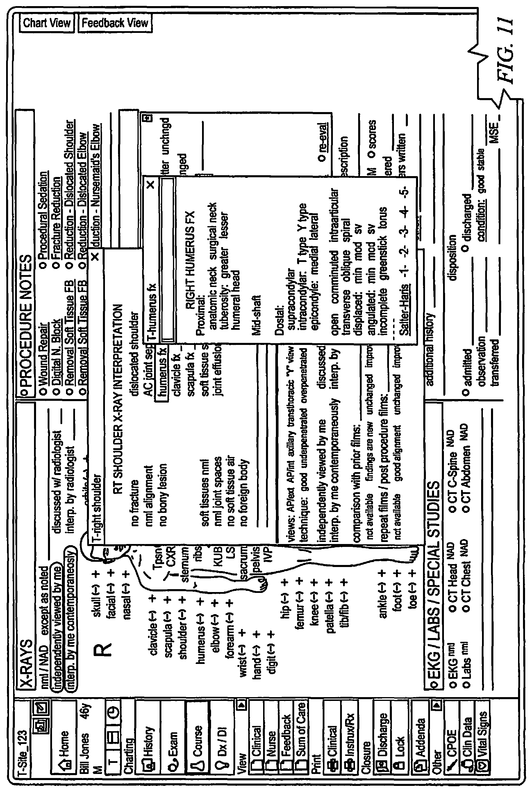 Patent US11783291 Figure 11 – Systems and methods for coding data from a medical encounter