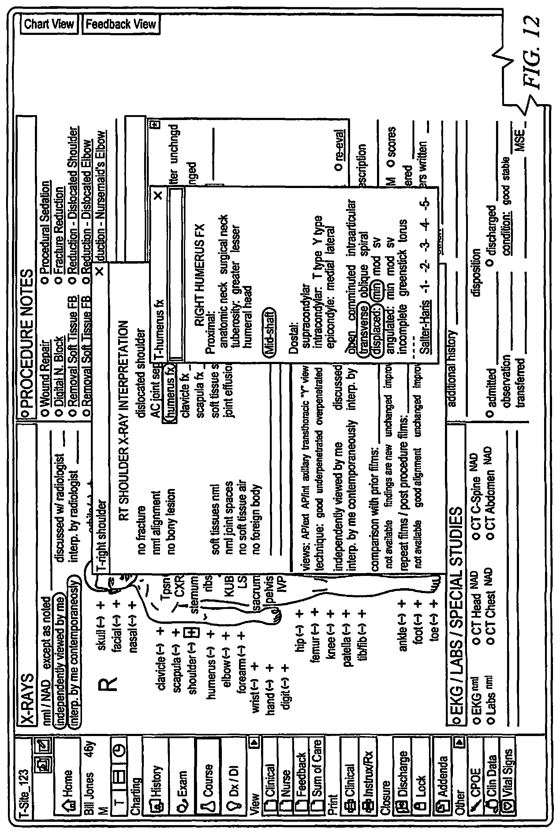 Patent US11783291 Figure 12 – Systems and methods for coding data from a medical encounter