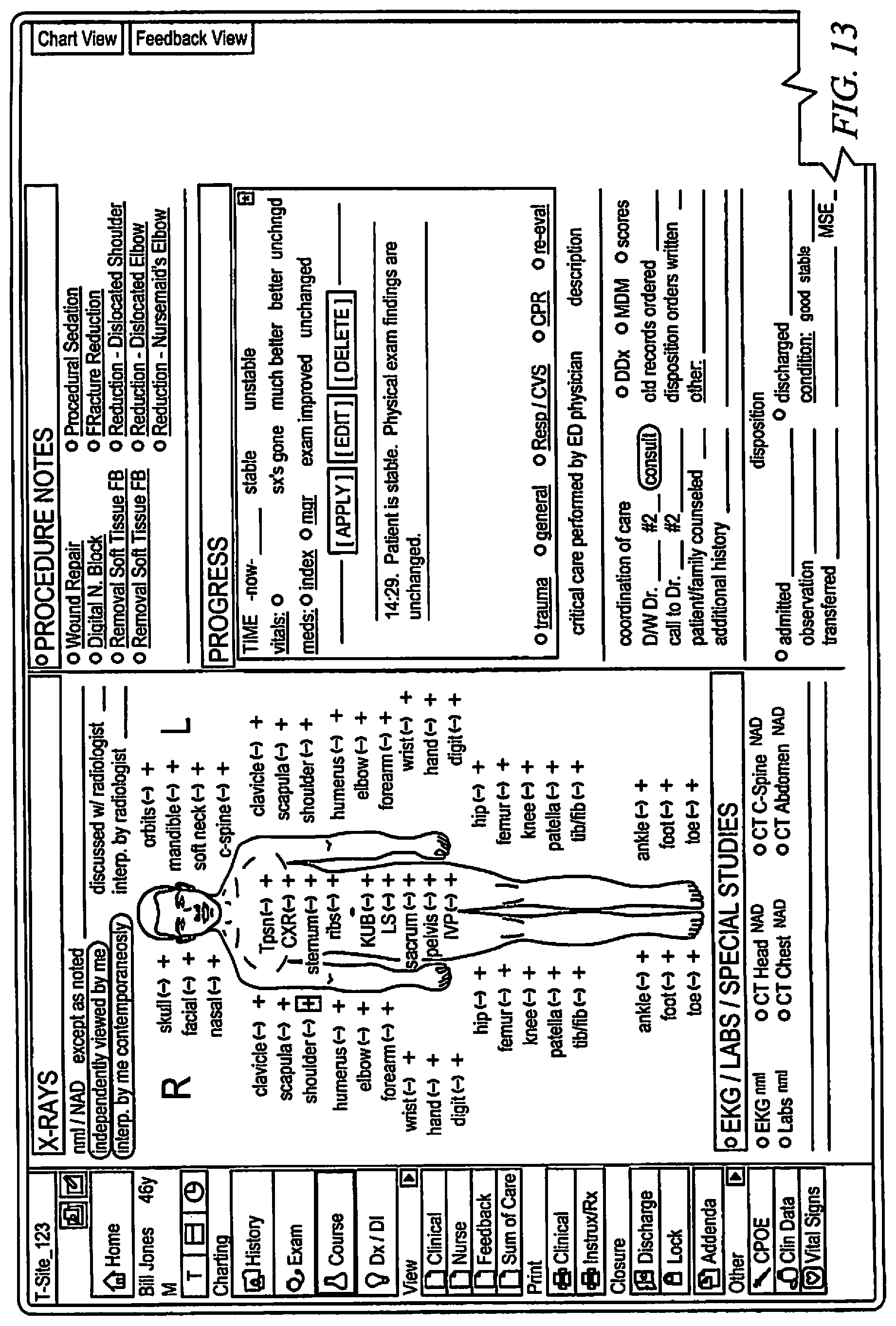 Patent US11783291 Figure 13 – Systems and methods for coding data from a medical encounter