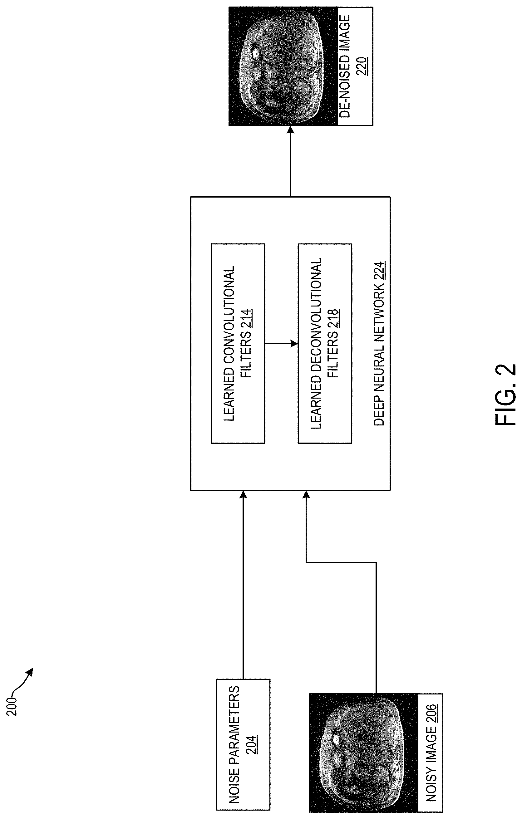 Patent US11783451 Figure 2 – Systems and methods for reducing colored noise in medical images using deep neural network