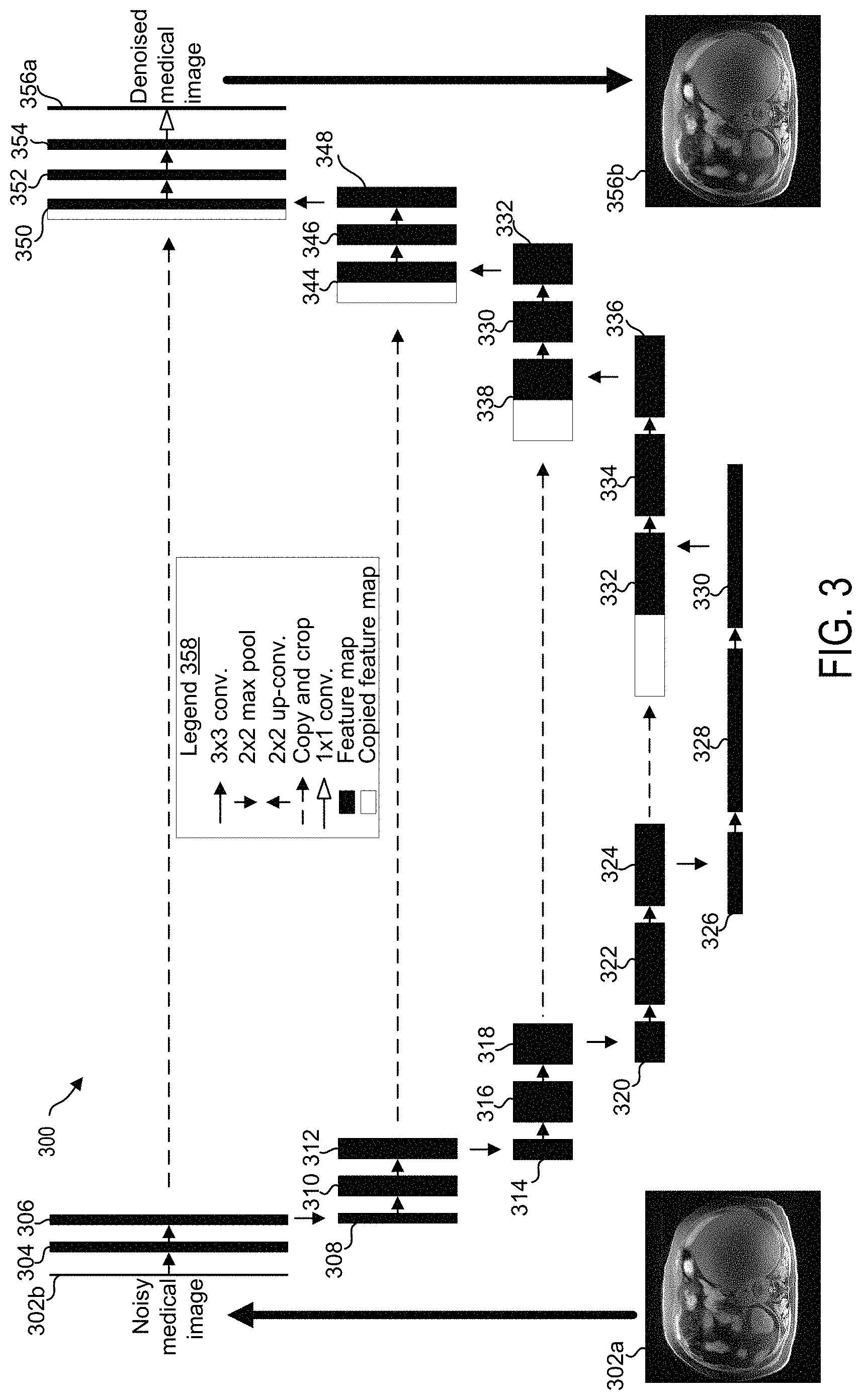 Patent US11783451 Figure 3 – Systems and methods for reducing colored noise in medical images using deep neural network