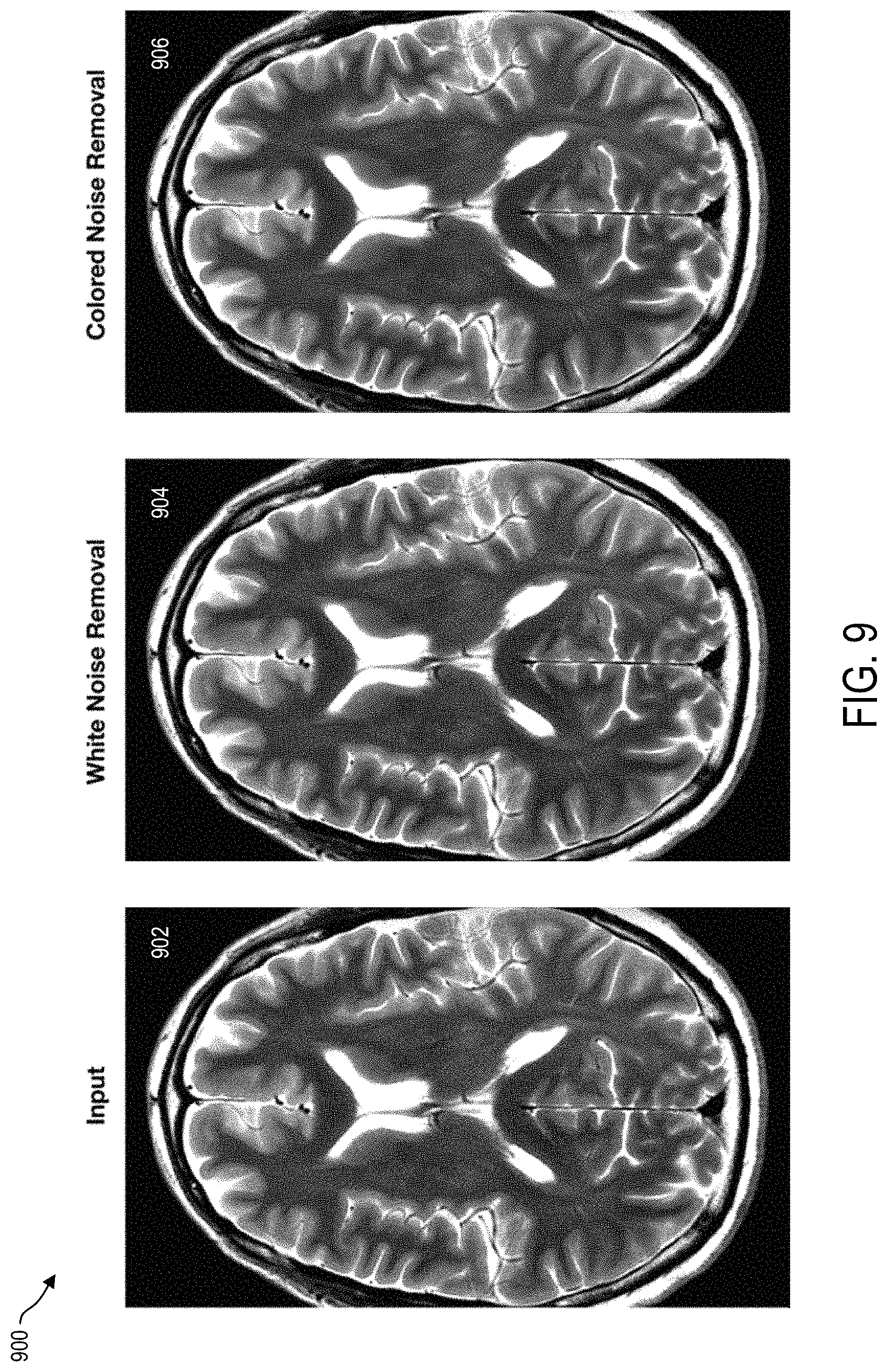 Patent US11783451 Figure 9 – Systems and methods for reducing colored noise in medical images using deep neural network