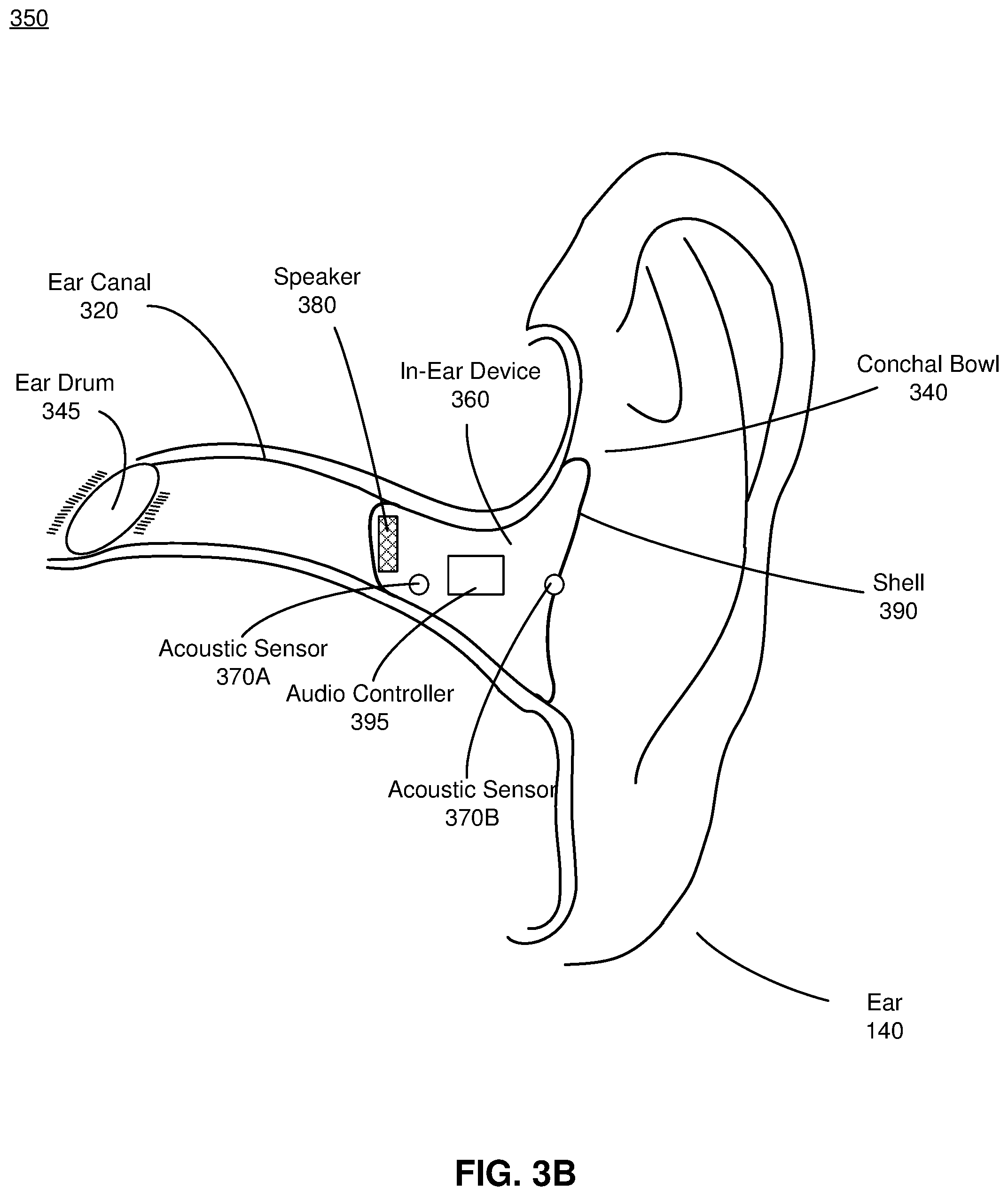 Patent US11783475 Figure 4 – In ear device customization using machine learning