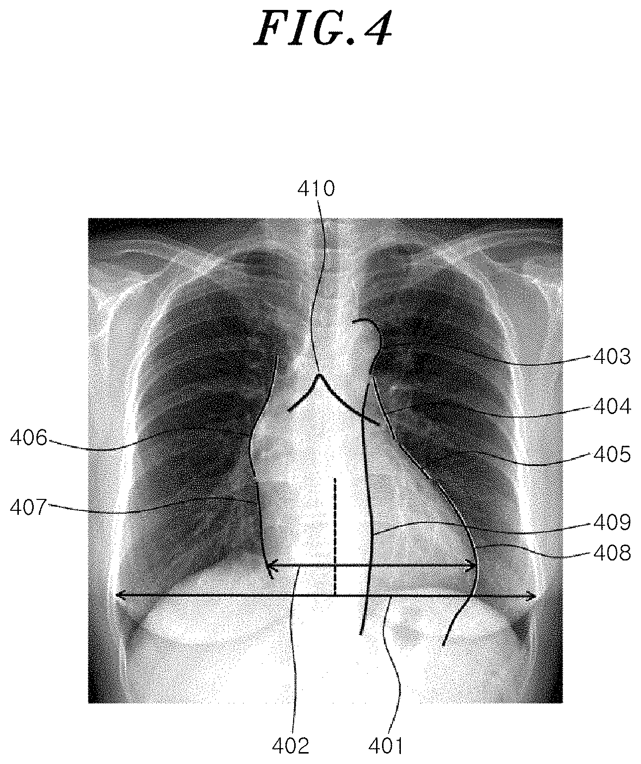 Patent US11783477 Figure 4 – Medical image process apparatus, medical image learning method, and medical image process method