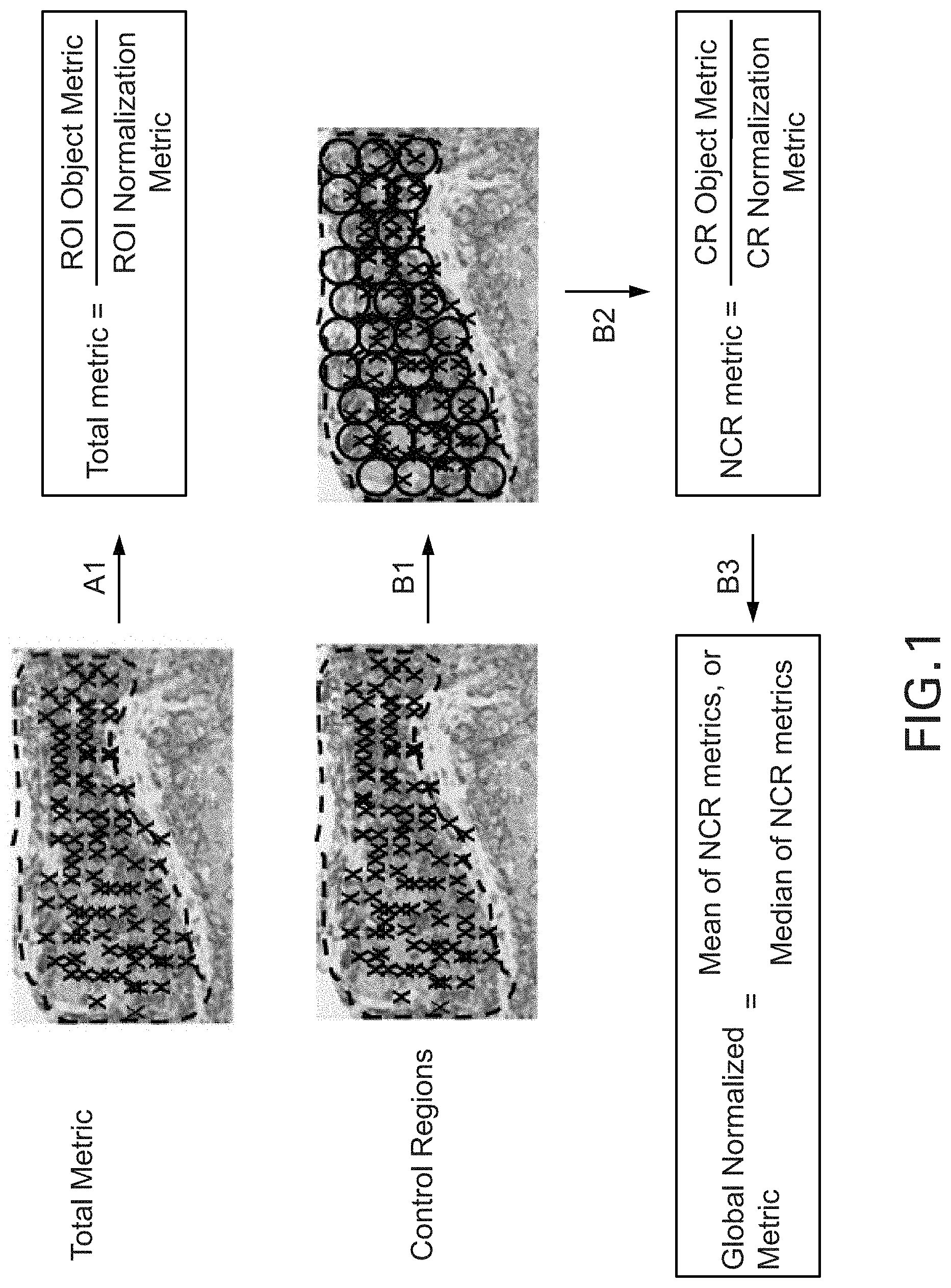 Patent US11783478 Figure 1 – Methods and systems for evaluation of immune cell infiltrate in tumor samples