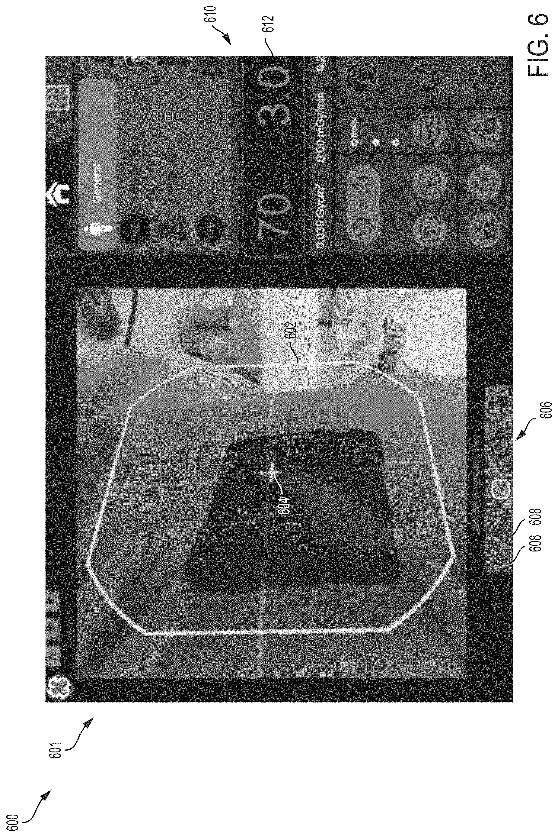 Patent US11783479 Figure 5 – Methods and systems for a field-of-view preview
