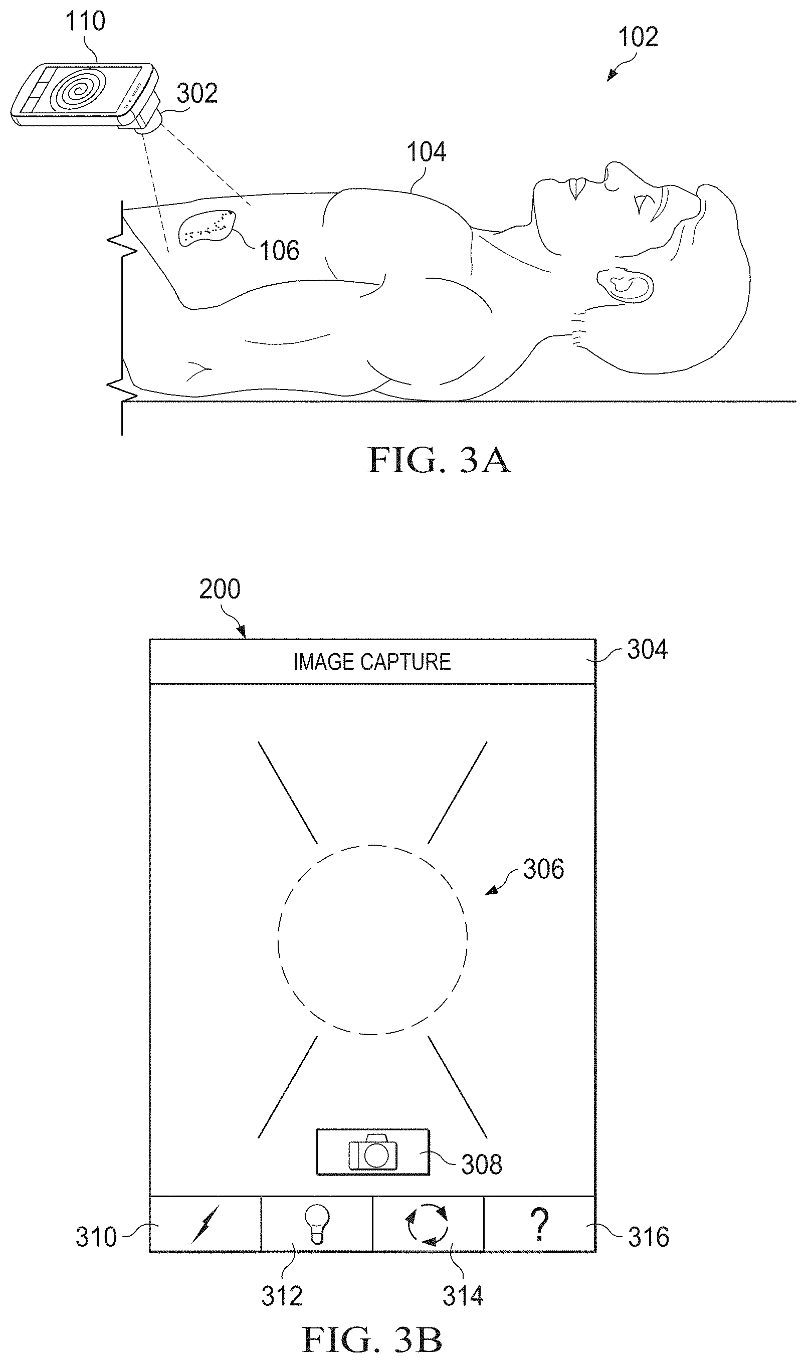 Patent US11783480 Figure 3 – Semi-automated system for real-time wound image segmentation and photogrammetry on a mobile platform