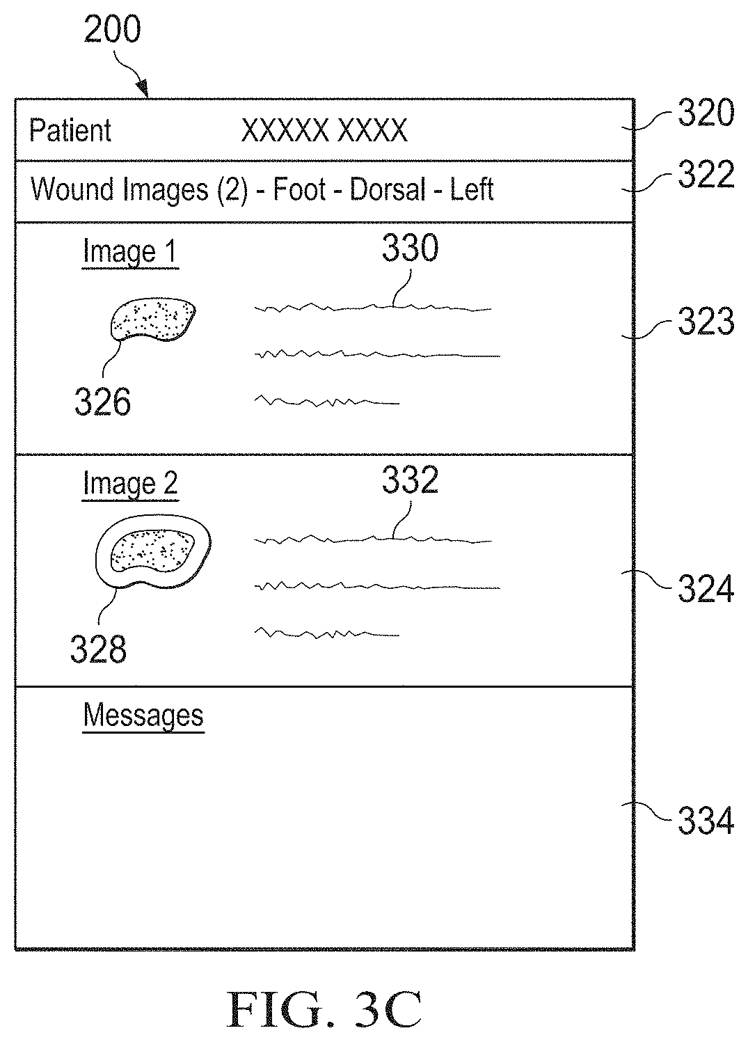 Patent US11783480 Figure 4 – Semi-automated system for real-time wound image segmentation and photogrammetry on a mobile platform