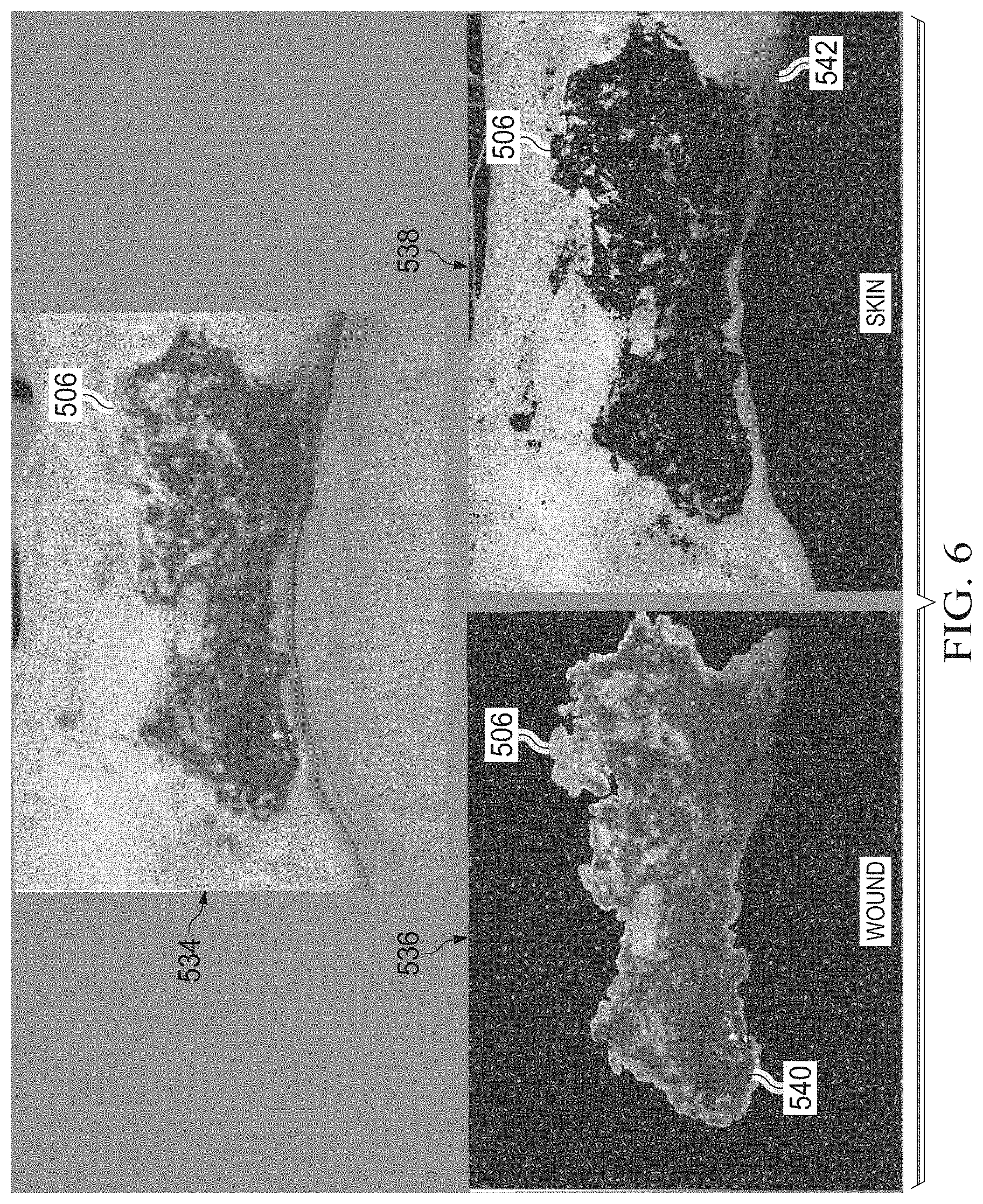 Patent US11783480 Figure 9 – Semi-automated system for real-time wound image segmentation and photogrammetry on a mobile platform