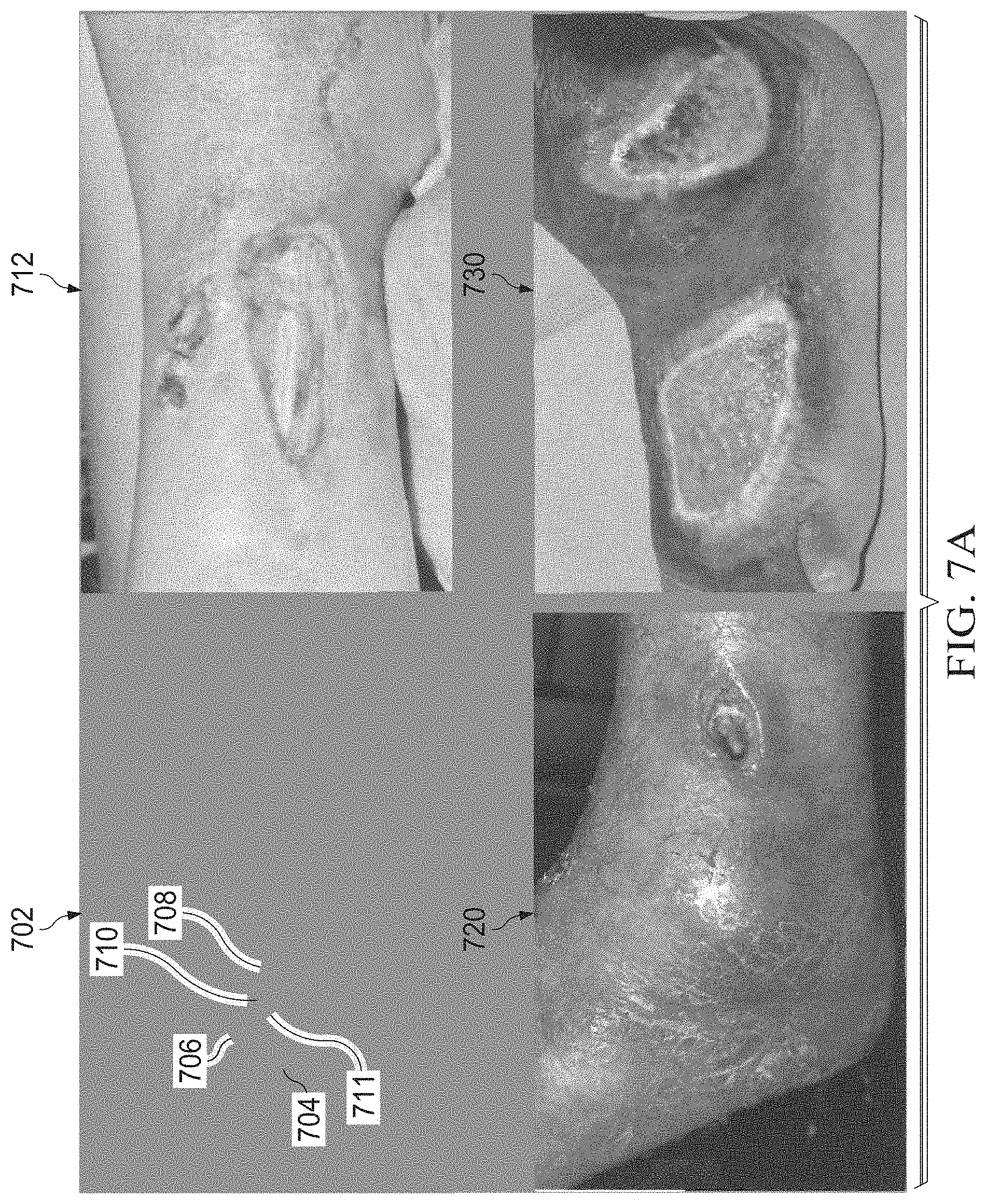 Patent US11783480 Figure 10 – Semi-automated system for real-time wound image segmentation and photogrammetry on a mobile platform