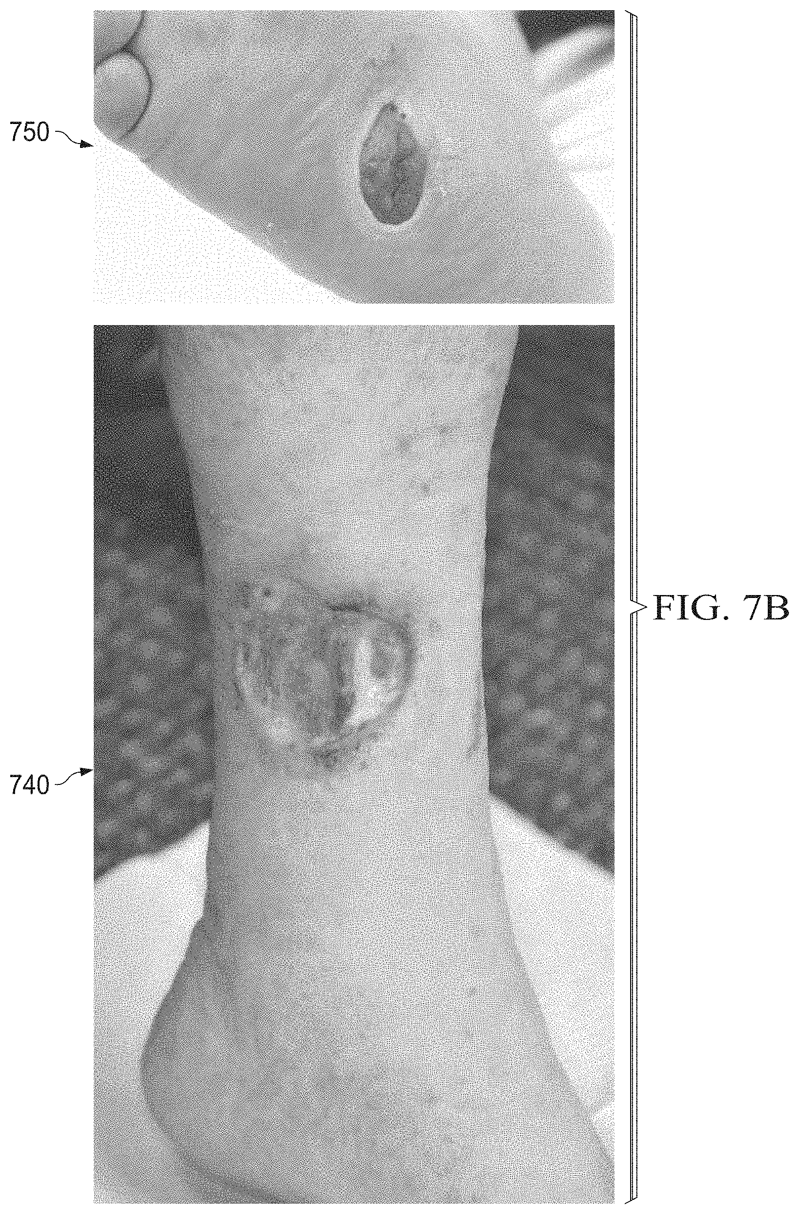 Patent US11783480 Figure 11 – Semi-automated system for real-time wound image segmentation and photogrammetry on a mobile platform
