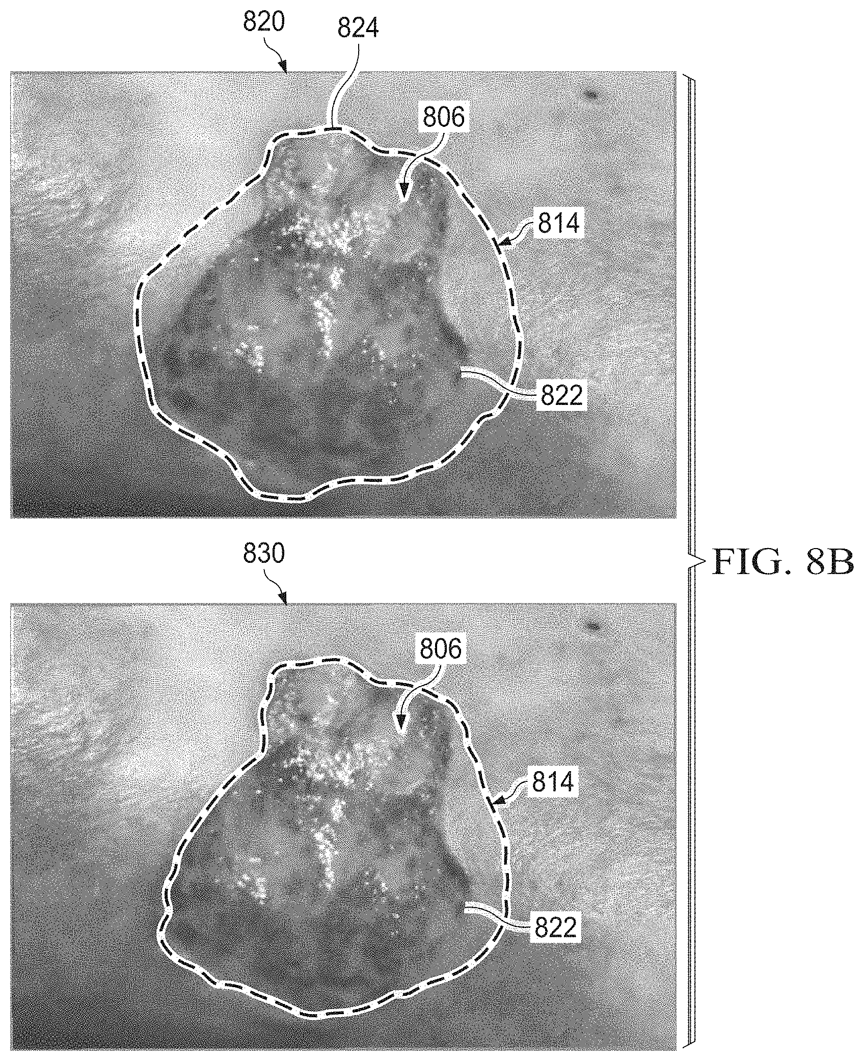 Patent US11783480 Figure 13 – Semi-automated system for real-time wound image segmentation and photogrammetry on a mobile platform