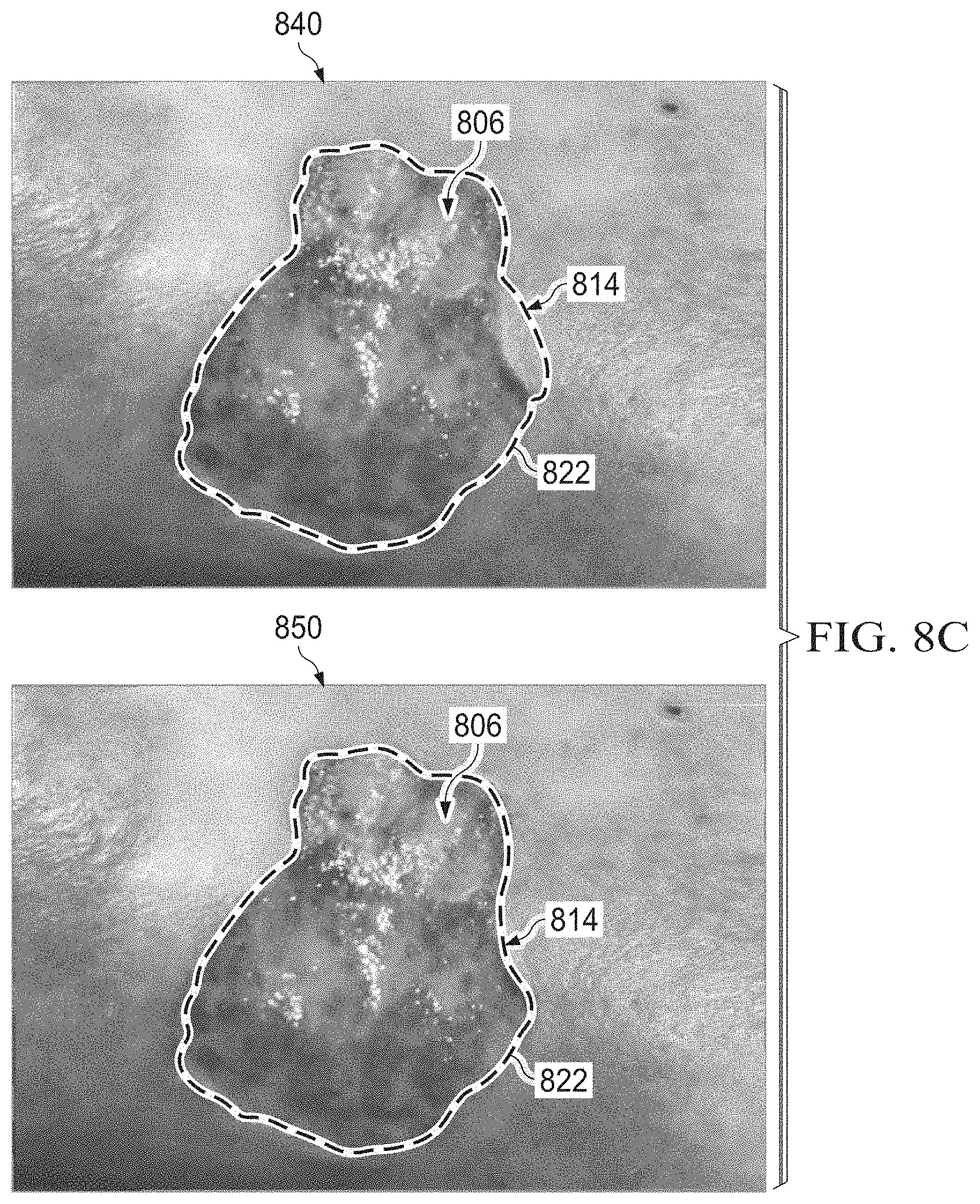 Patent US11783480 Figure 14 – Semi-automated system for real-time wound image segmentation and photogrammetry on a mobile platform