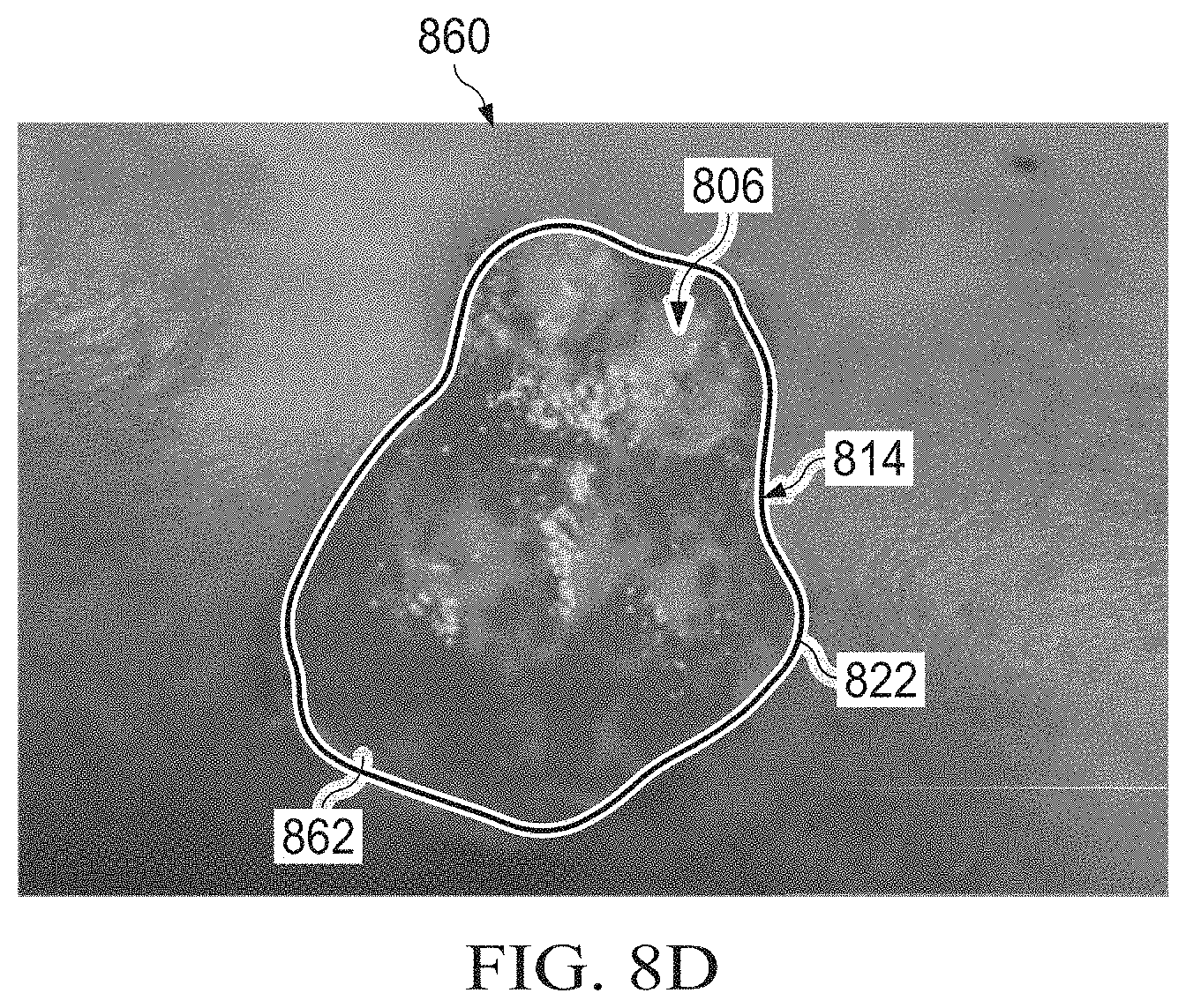 Patent US11783480 Figure 15 – Semi-automated system for real-time wound image segmentation and photogrammetry on a mobile platform