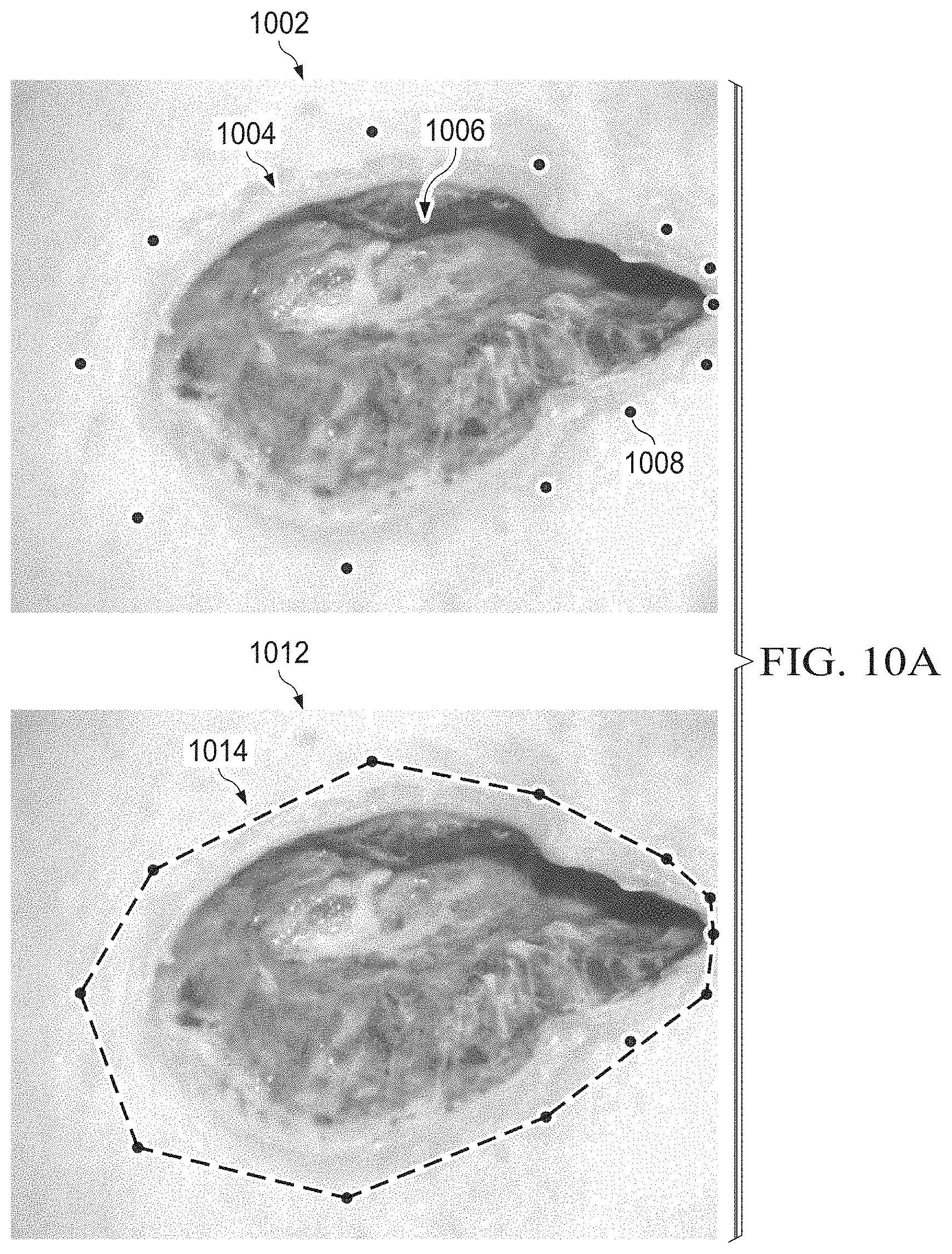 Patent US11783480 Figure 17 – Semi-automated system for real-time wound image segmentation and photogrammetry on a mobile platform