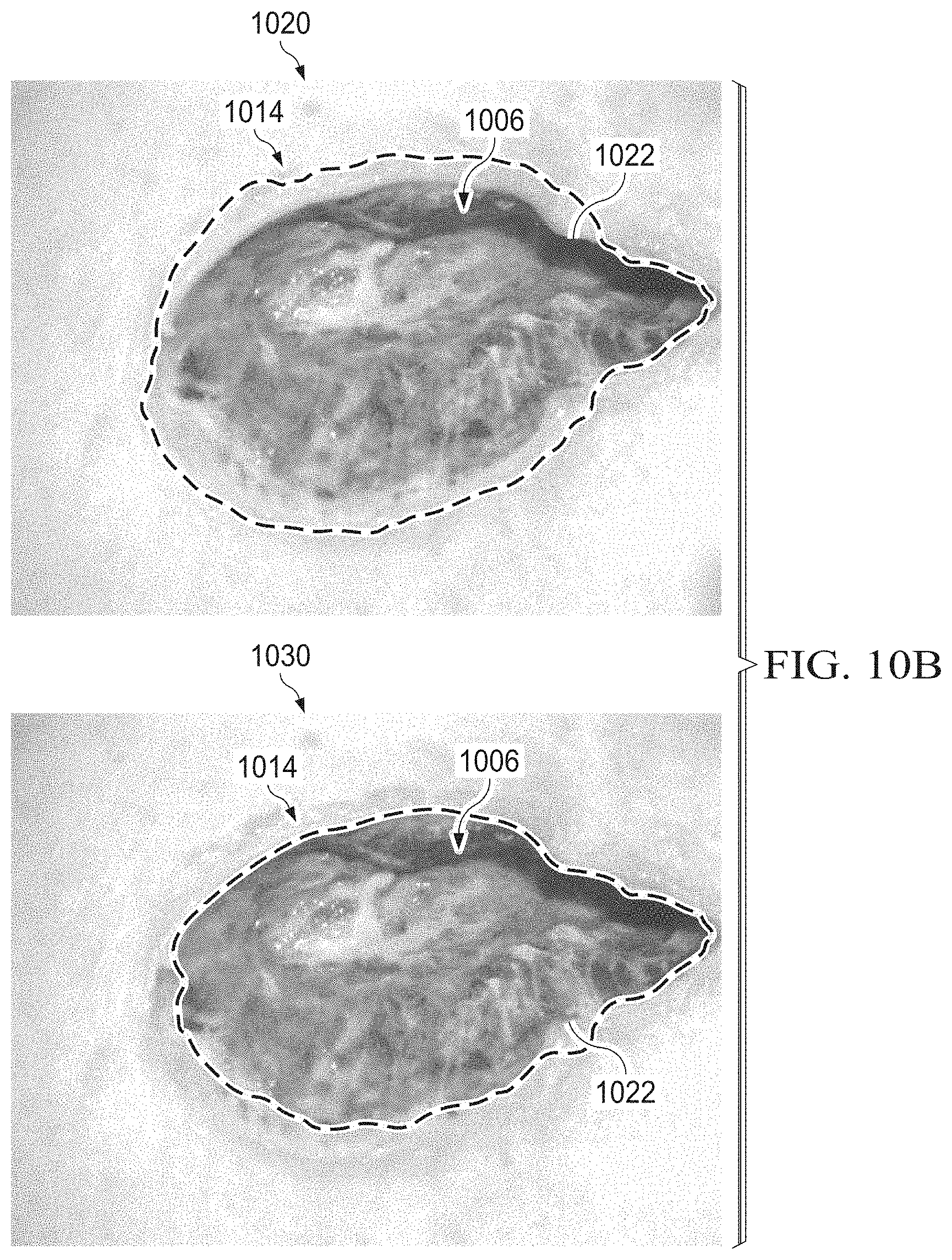 Patent US11783480 Figure 18 – Semi-automated system for real-time wound image segmentation and photogrammetry on a mobile platform