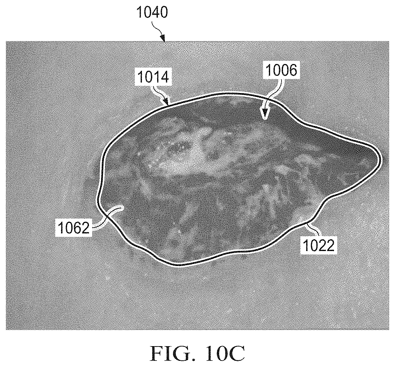 Patent US11783480 Figure 19 – Semi-automated system for real-time wound image segmentation and photogrammetry on a mobile platform