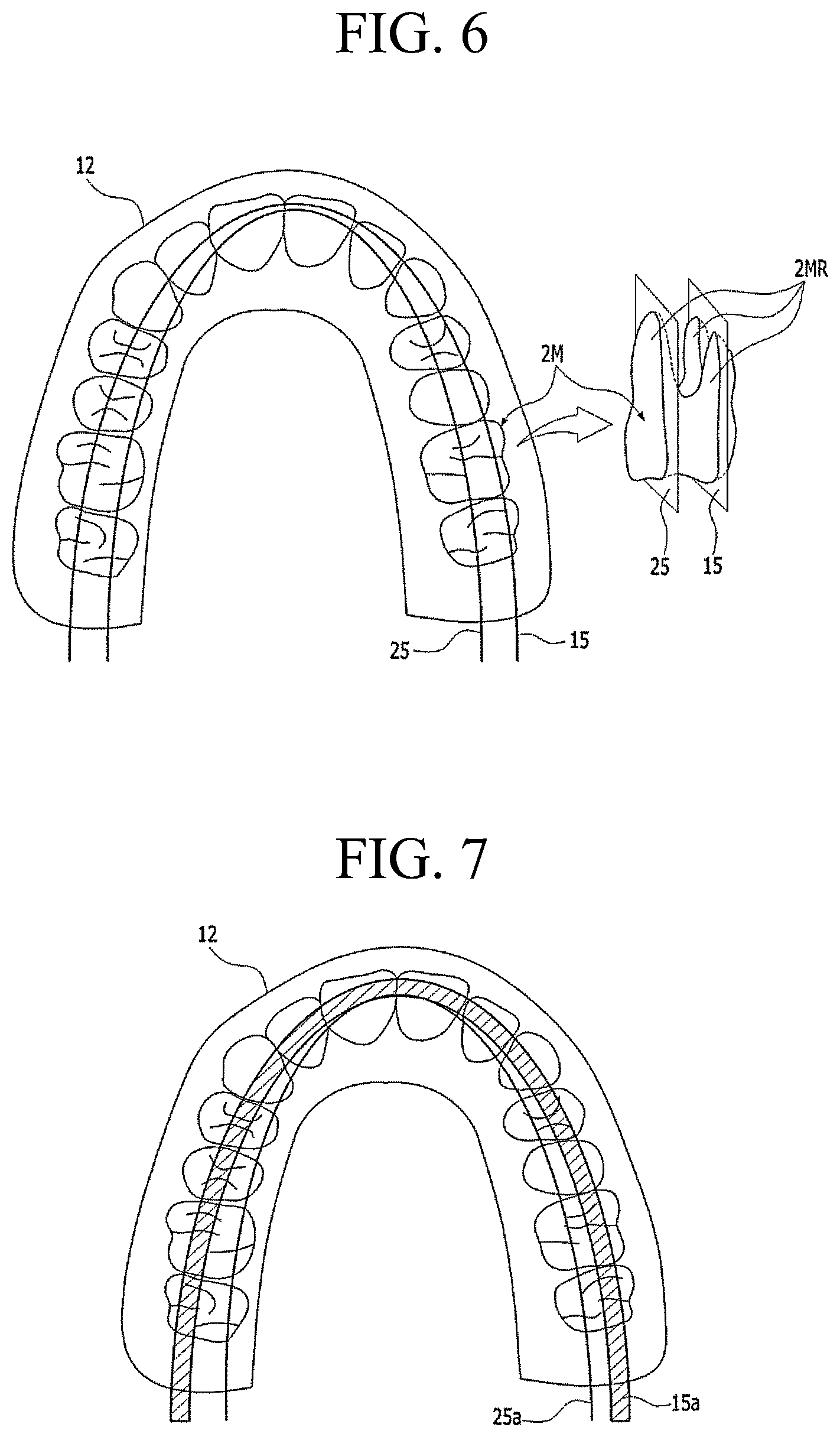 Patent US11783482 Figure 5 – Producing panoramic radiograph