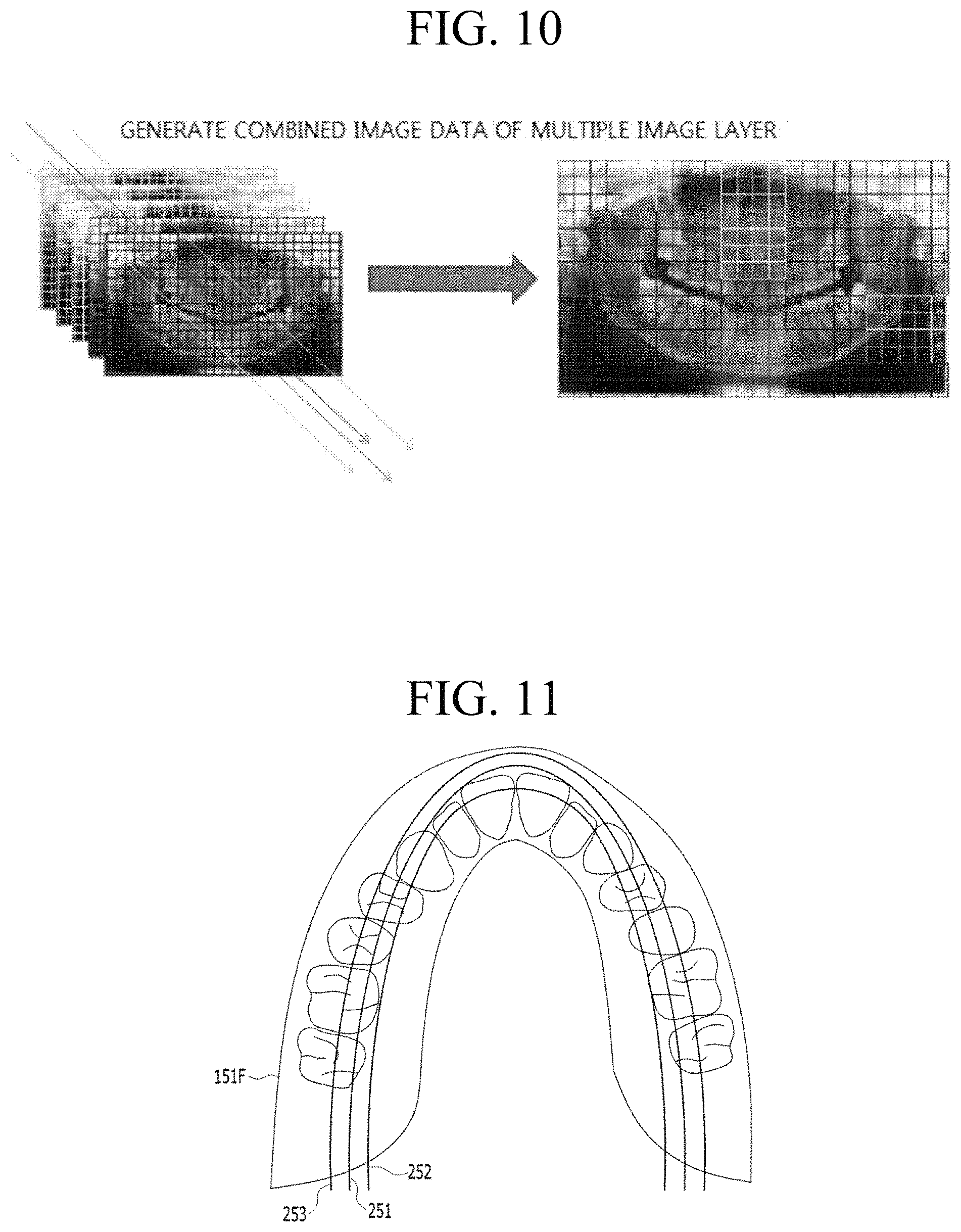 Patent US11783482 Figure 7 – Producing panoramic radiograph