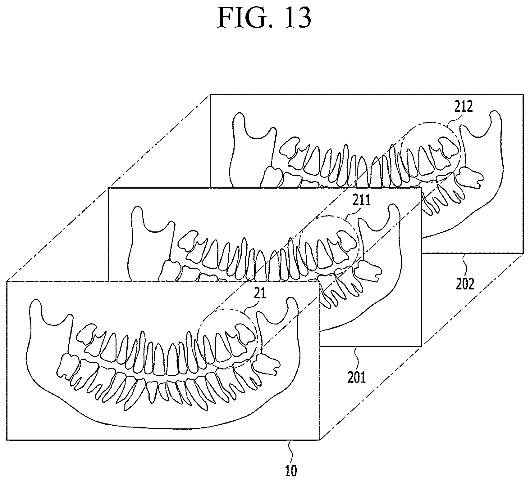 Patent US11783482 Figure 9 – Producing panoramic radiograph