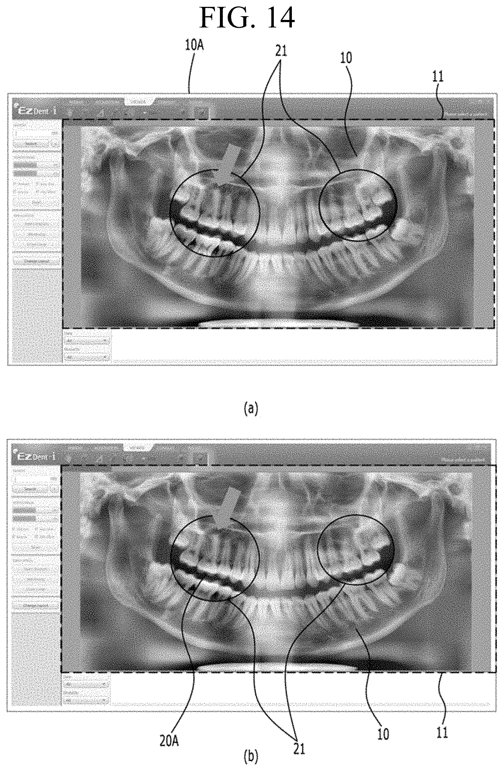 Patent US11783482 Figure 10 – Producing panoramic radiograph