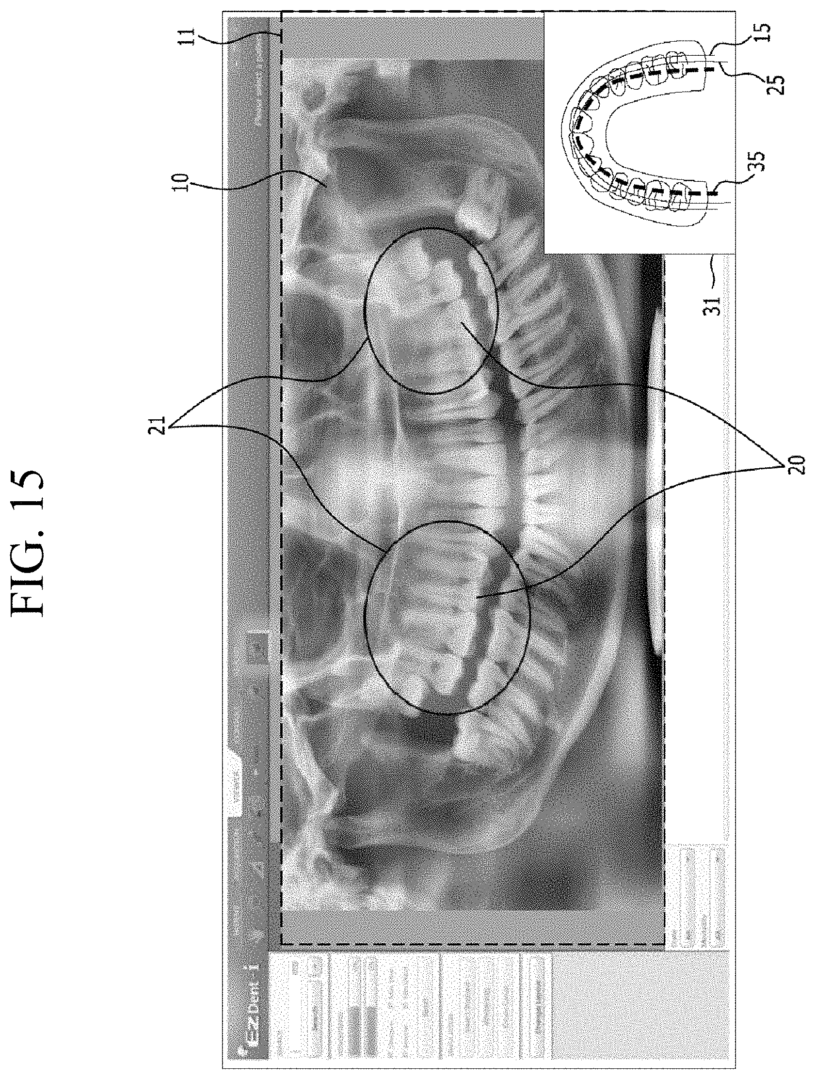 Patent US11783482 Figure 11 – Producing panoramic radiograph
