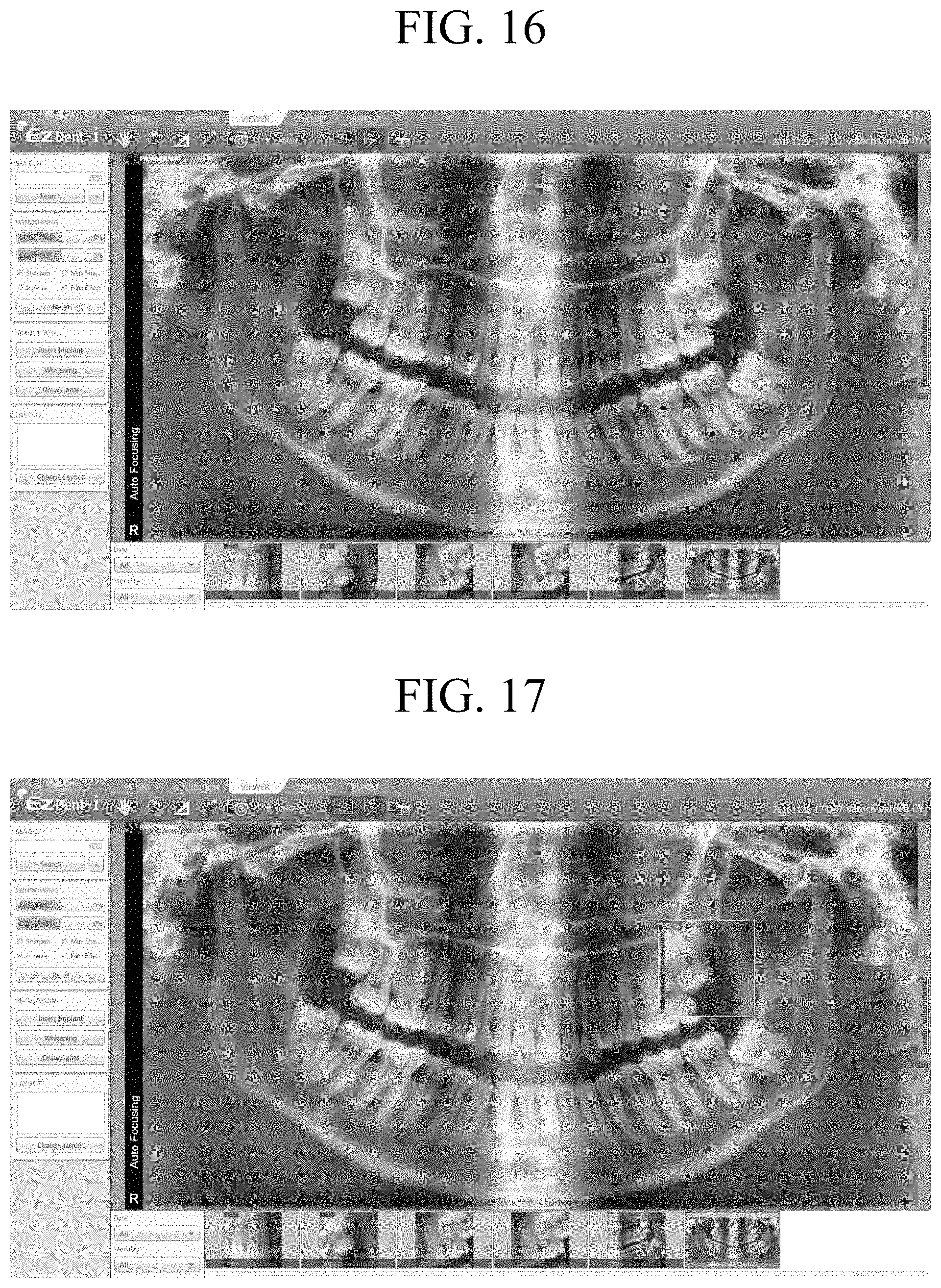 Patent US11783482 Figure 12 – Producing panoramic radiograph
