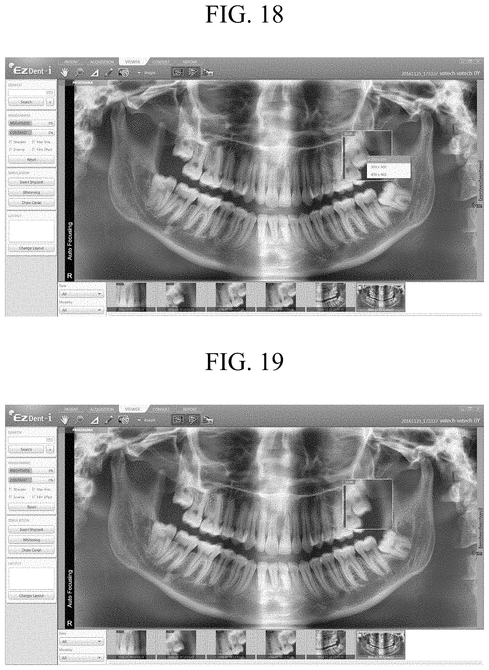 Patent US11783482 Figure 13 – Producing panoramic radiograph