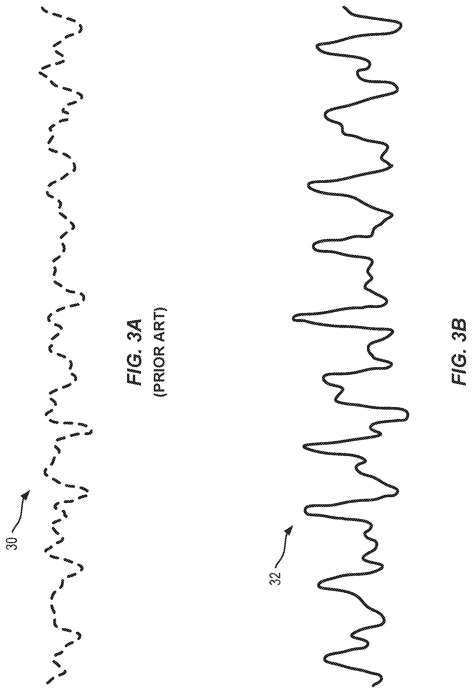 Patent US11783483 Figure 3 – Detecting abnormalities in vital signs of subjects of videos