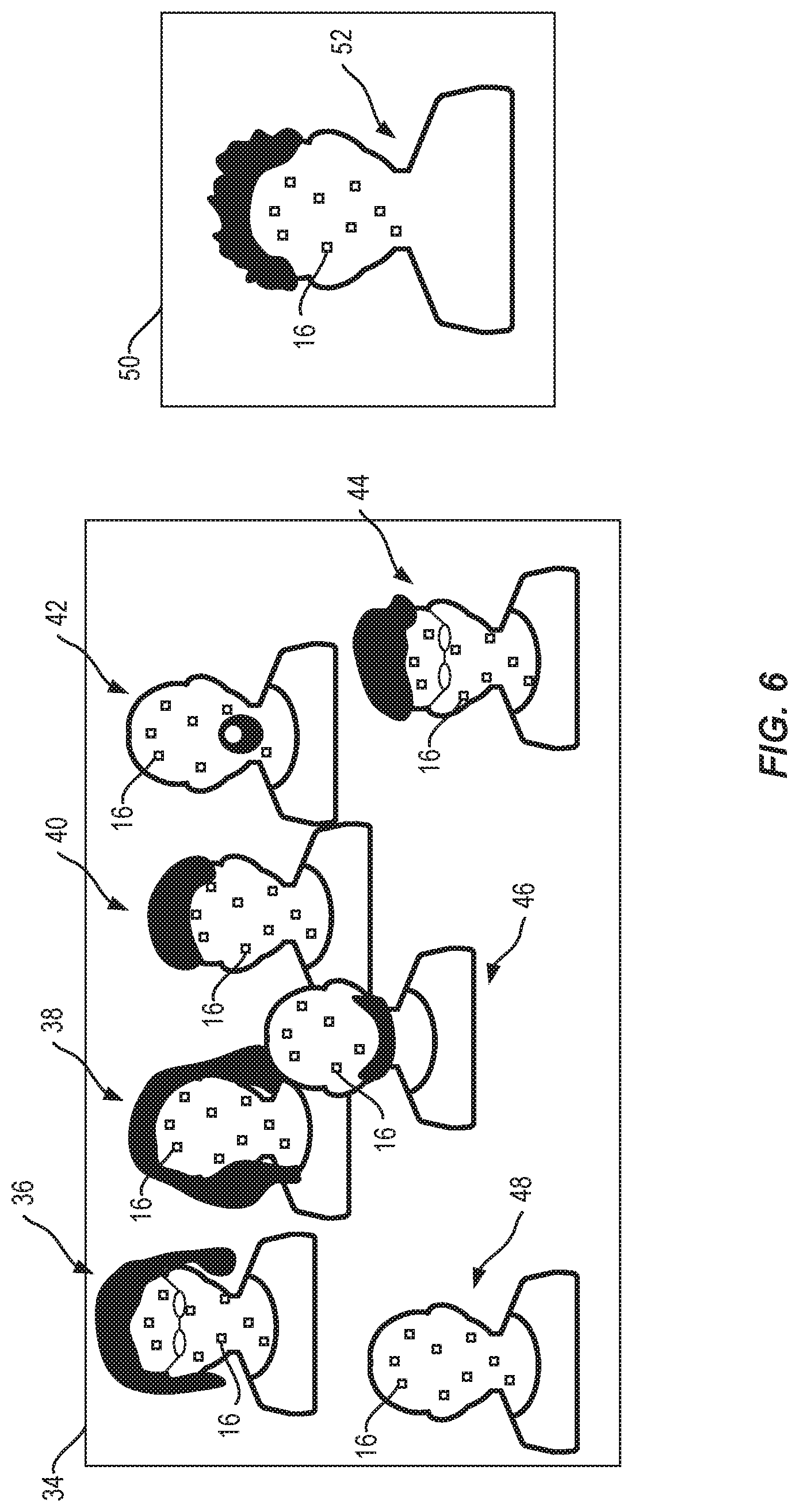 Patent US11783483 Figure 6 – Detecting abnormalities in vital signs of subjects of videos