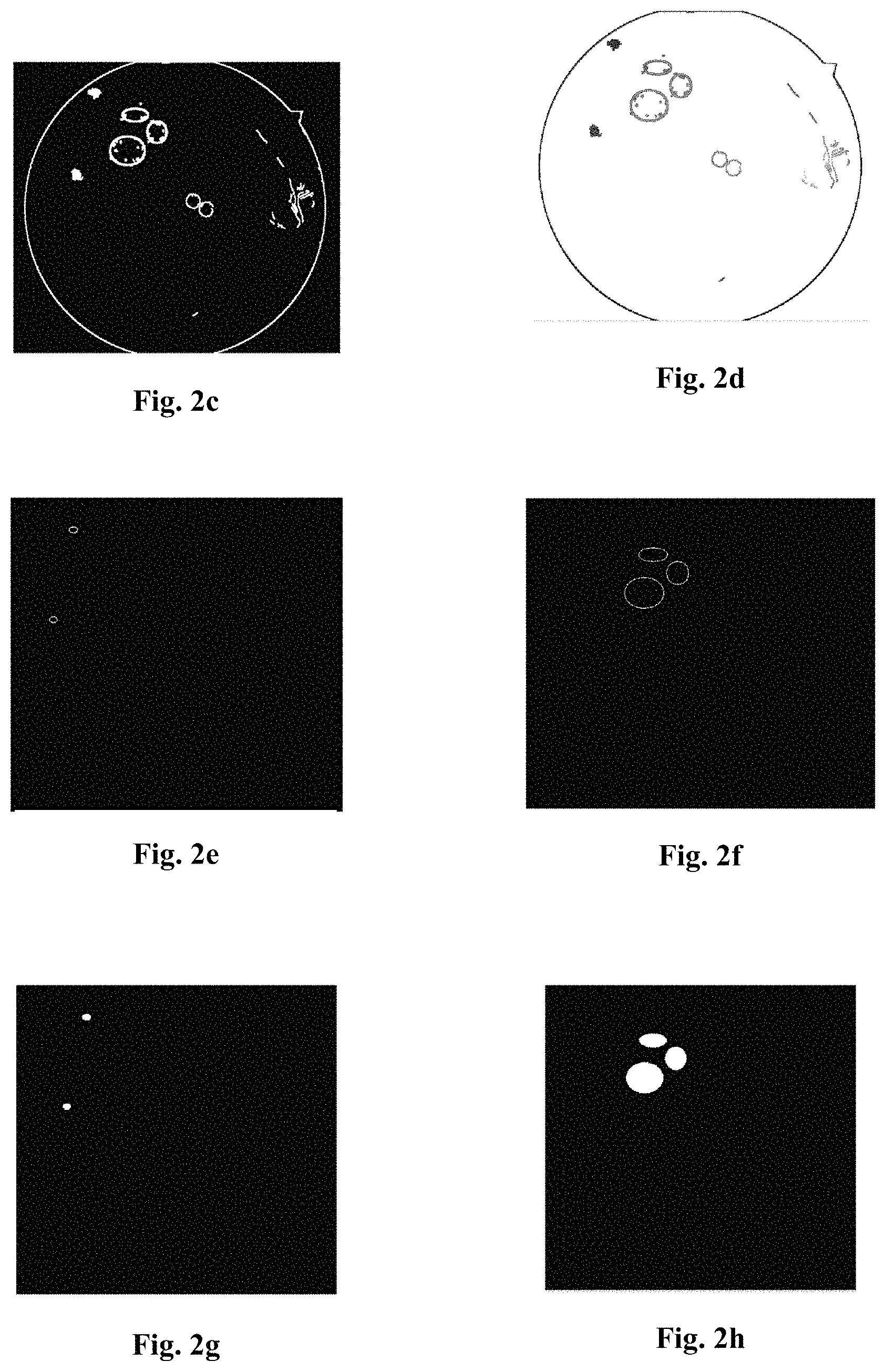 Patent US11783488 Figure 2 – Method and device of extracting label in medical image