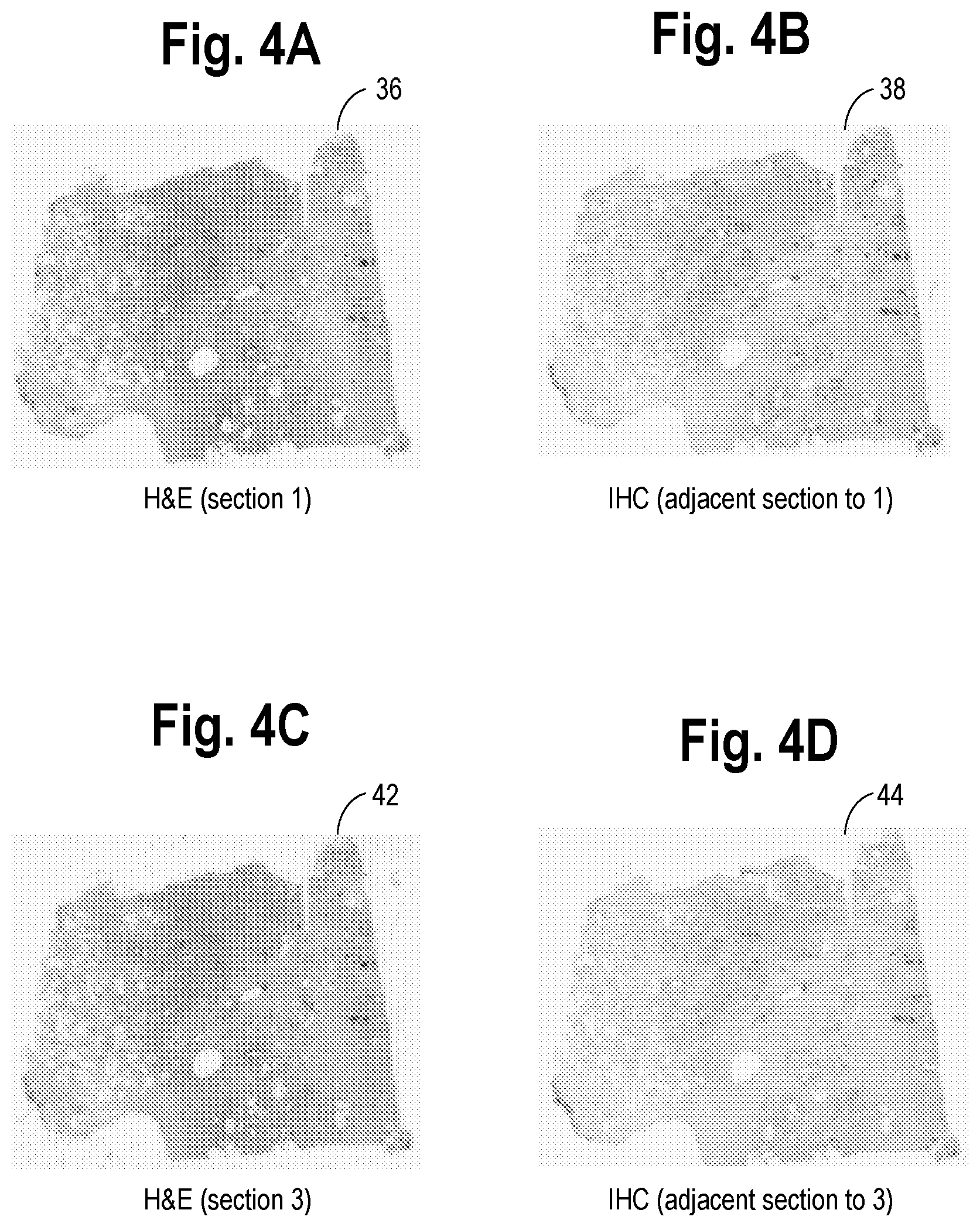 Patent US11783603 Figure 2 – Virtual staining for tissue slide images