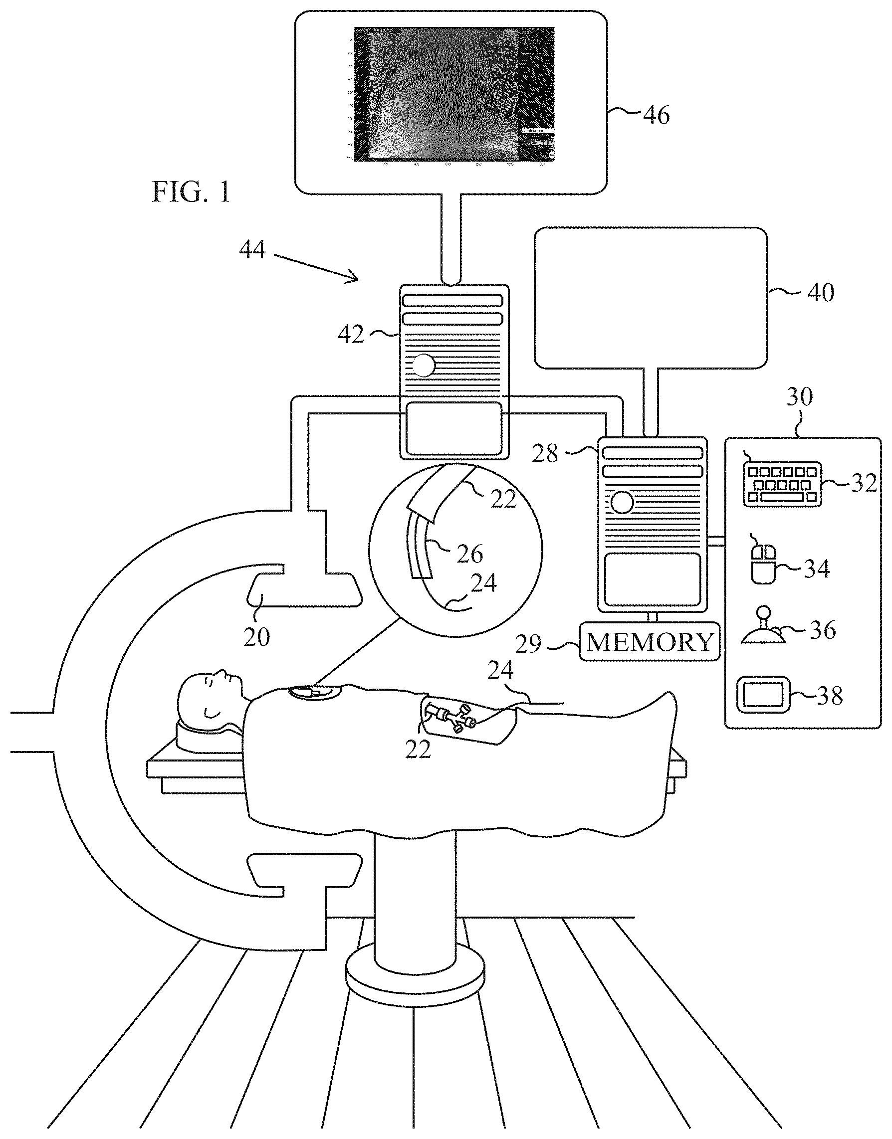 Patent US11783607 Figure 1 – Automatic image feature removal