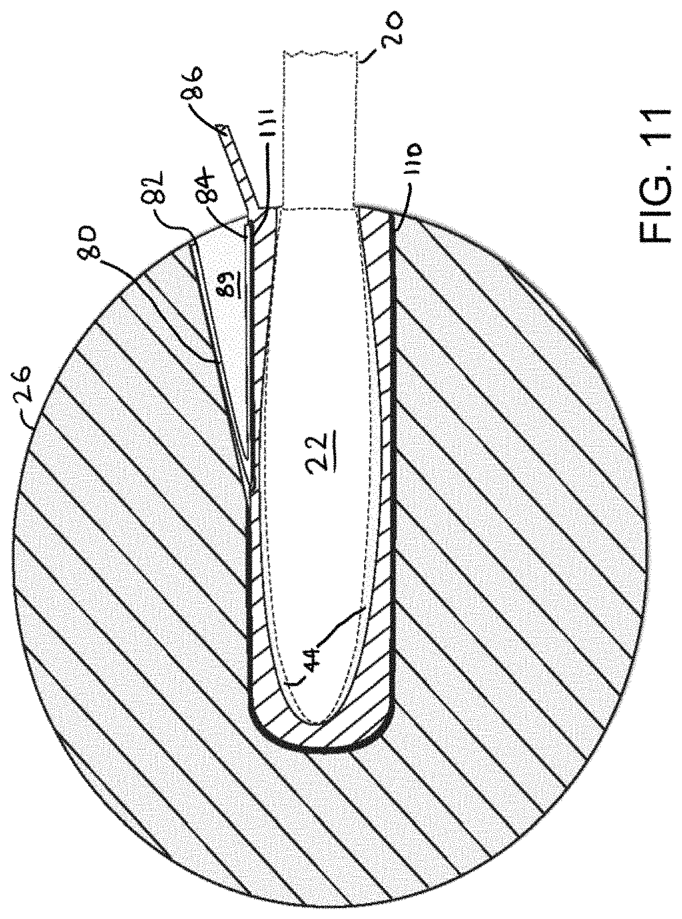 Patent US11783802 Figure 11 – Tremolo bar attachment accessory device