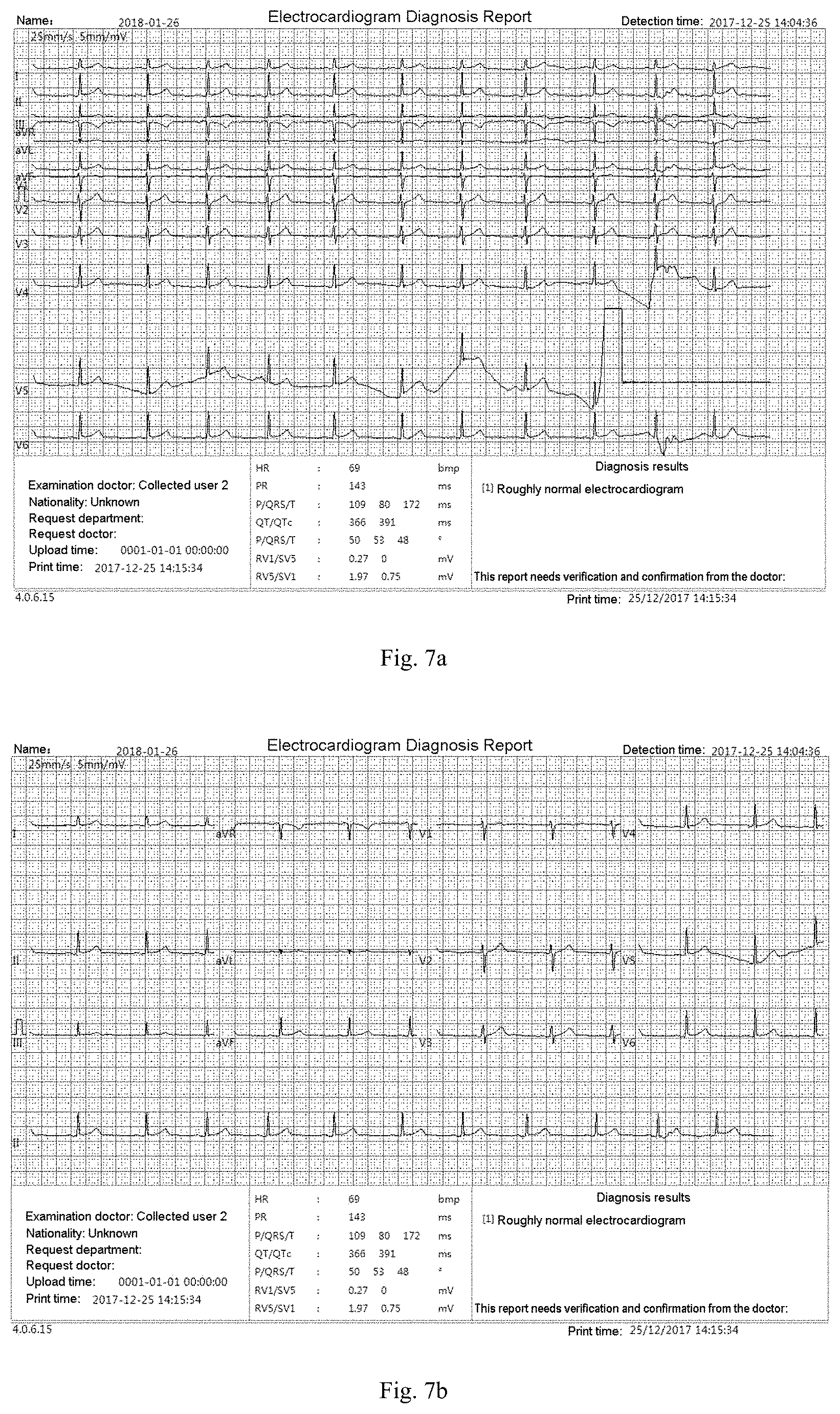 Patent US11783924 Figure 6 – ECG information processing method and ECG workstation